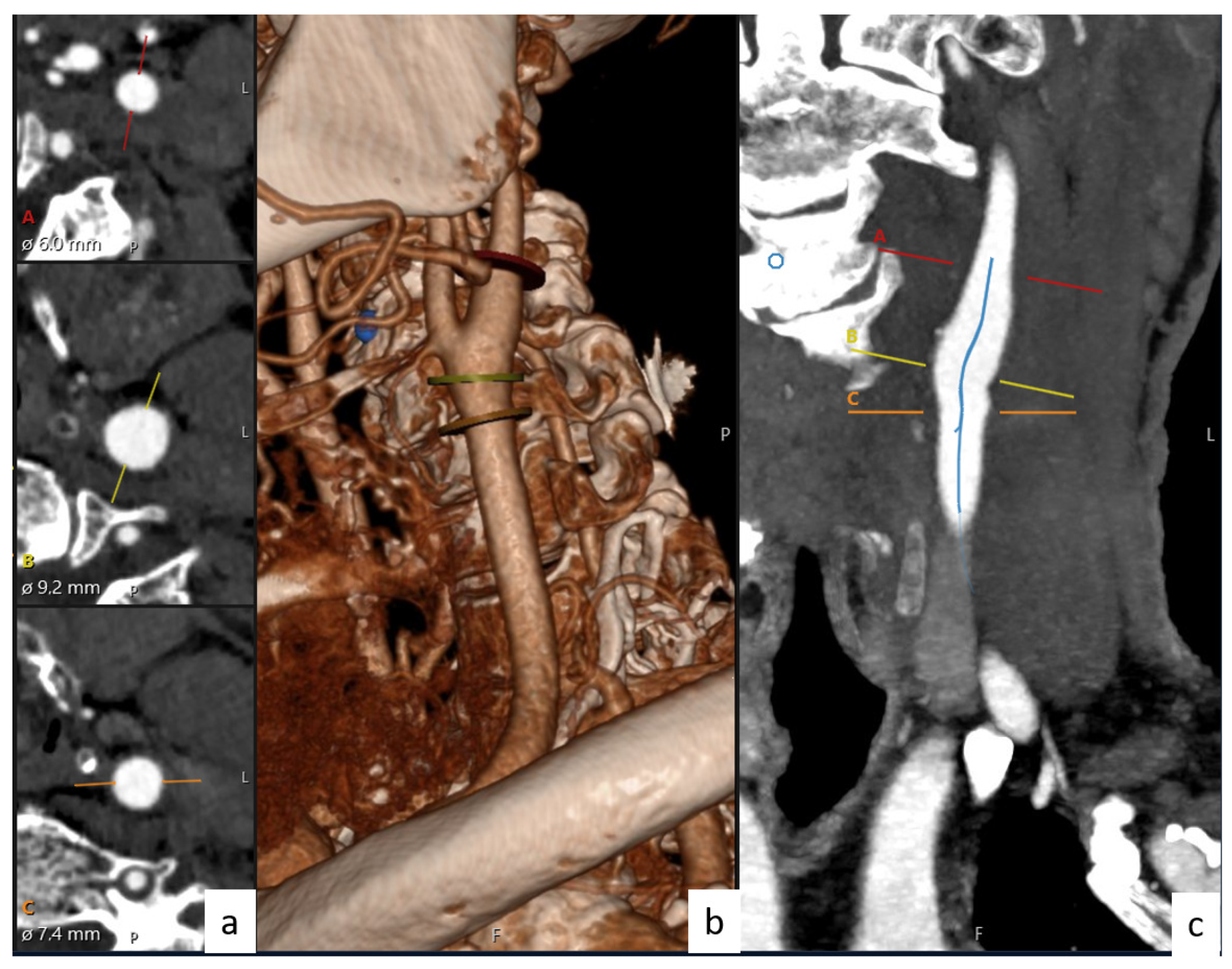 Tomography 10 00120 g002