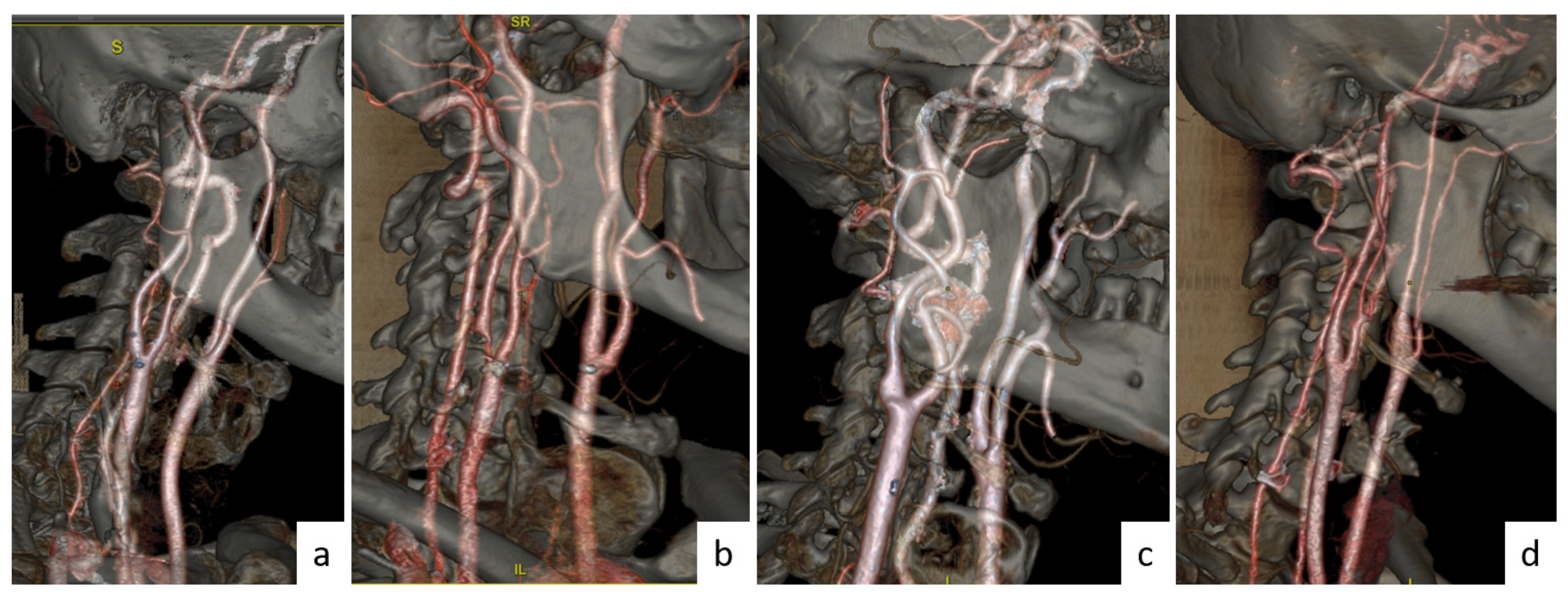 Tomography 10 00120 g003
