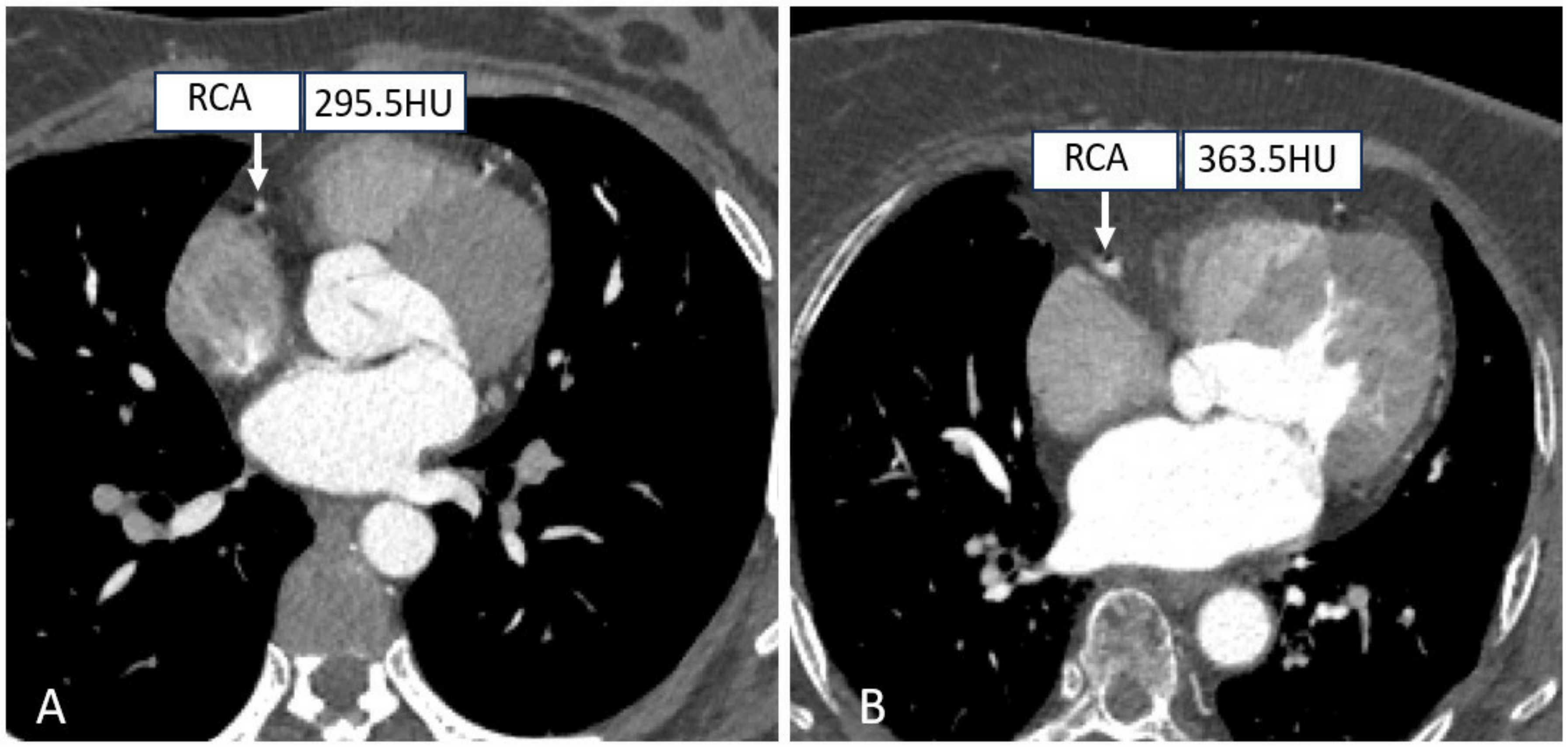Tomography 10 00127 g003