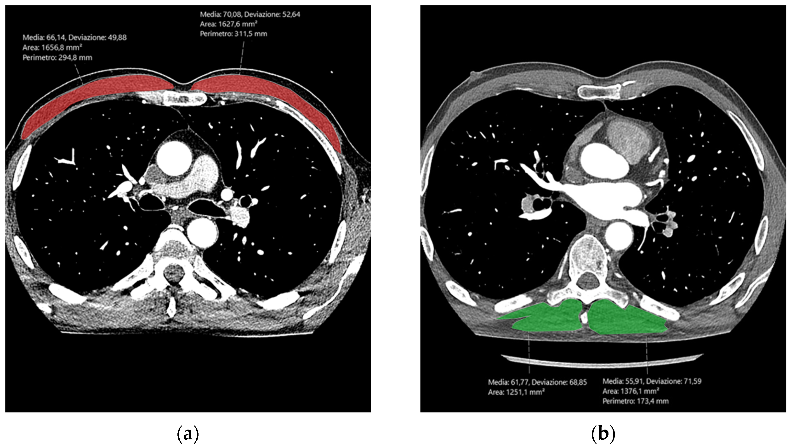 Tomography 10 00128 g001