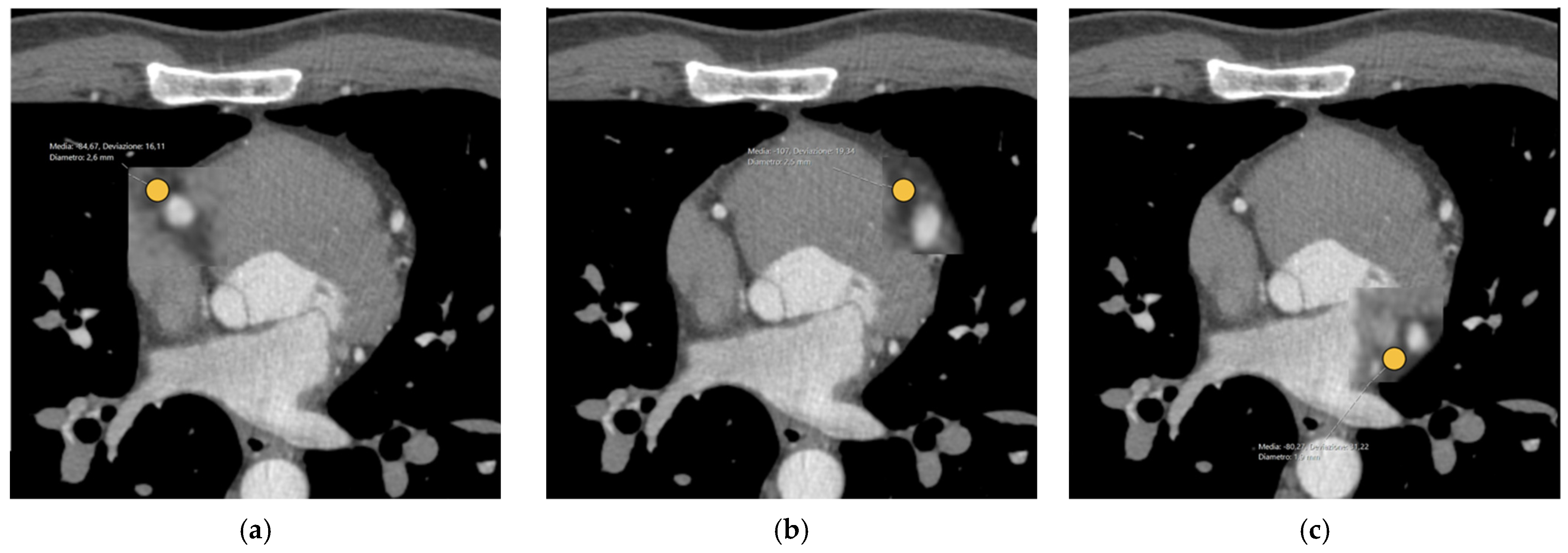Tomography 10 00128 g002
