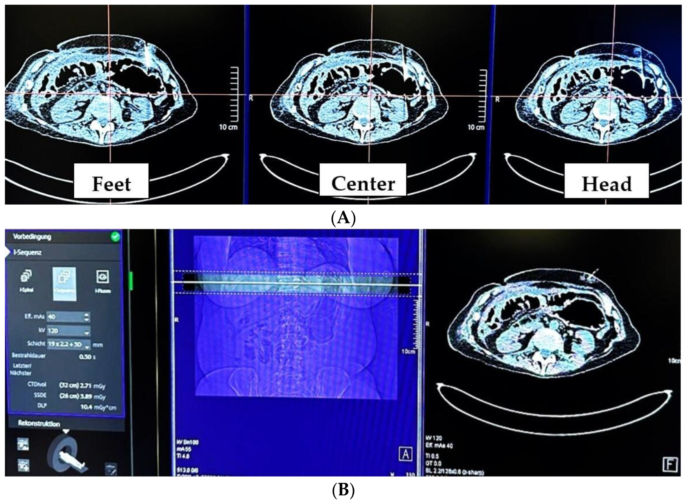 Tomography 10 00129 g002