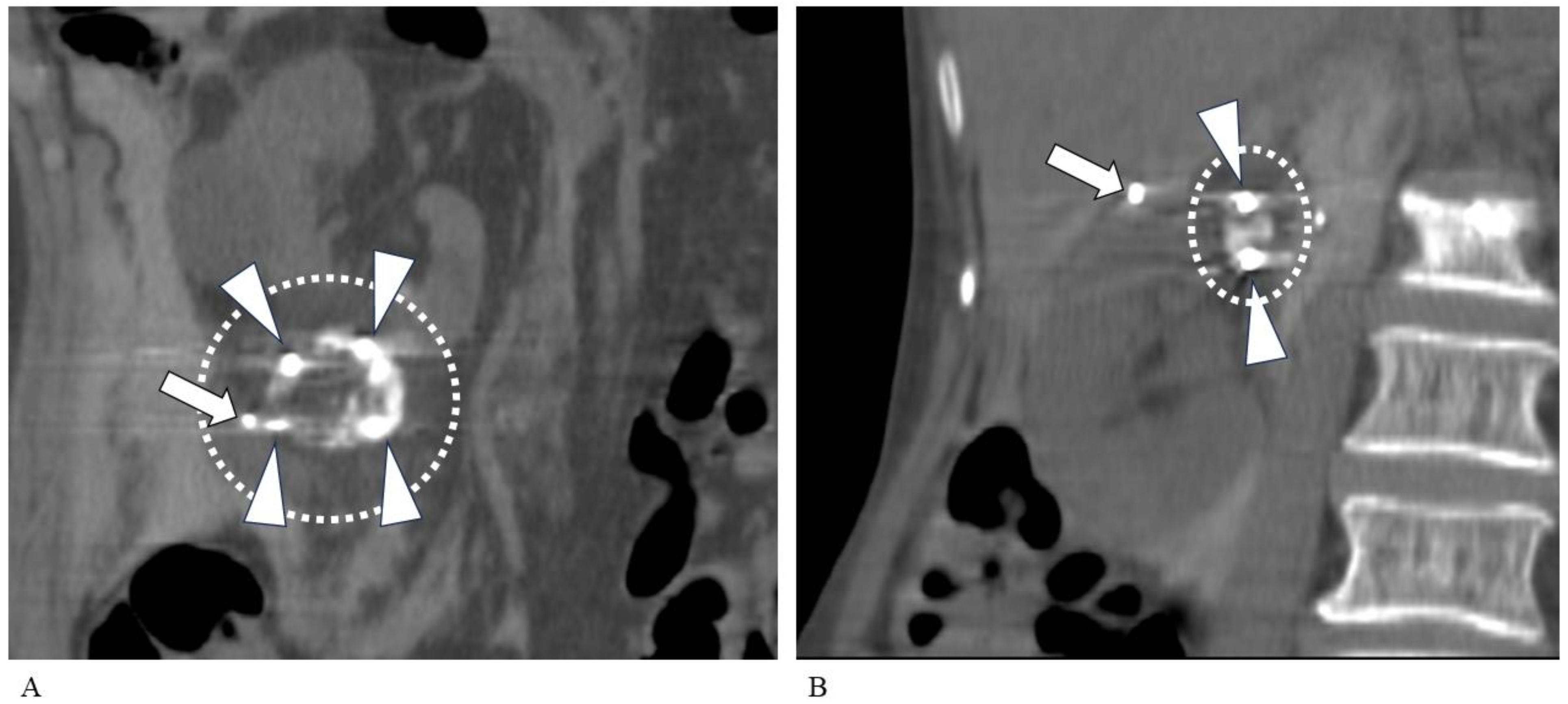 Tomography 10 00130 g002