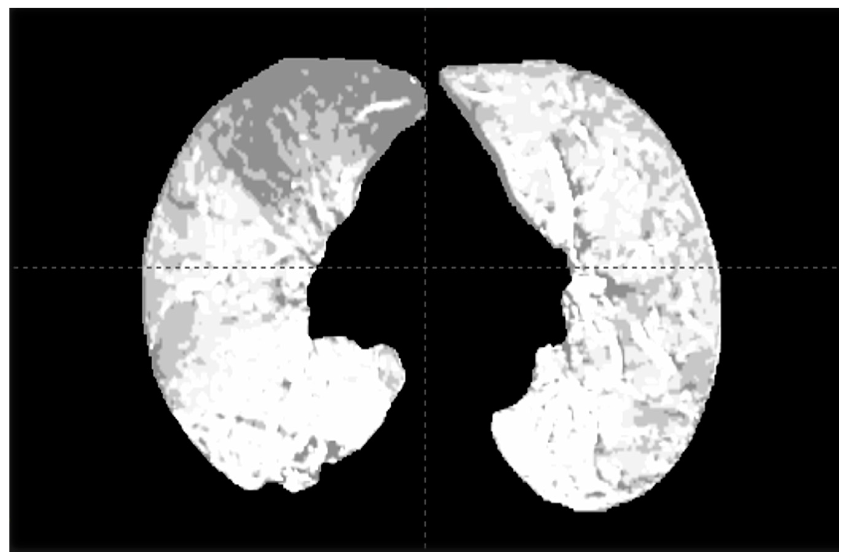 Tomography 10 00132 g001
