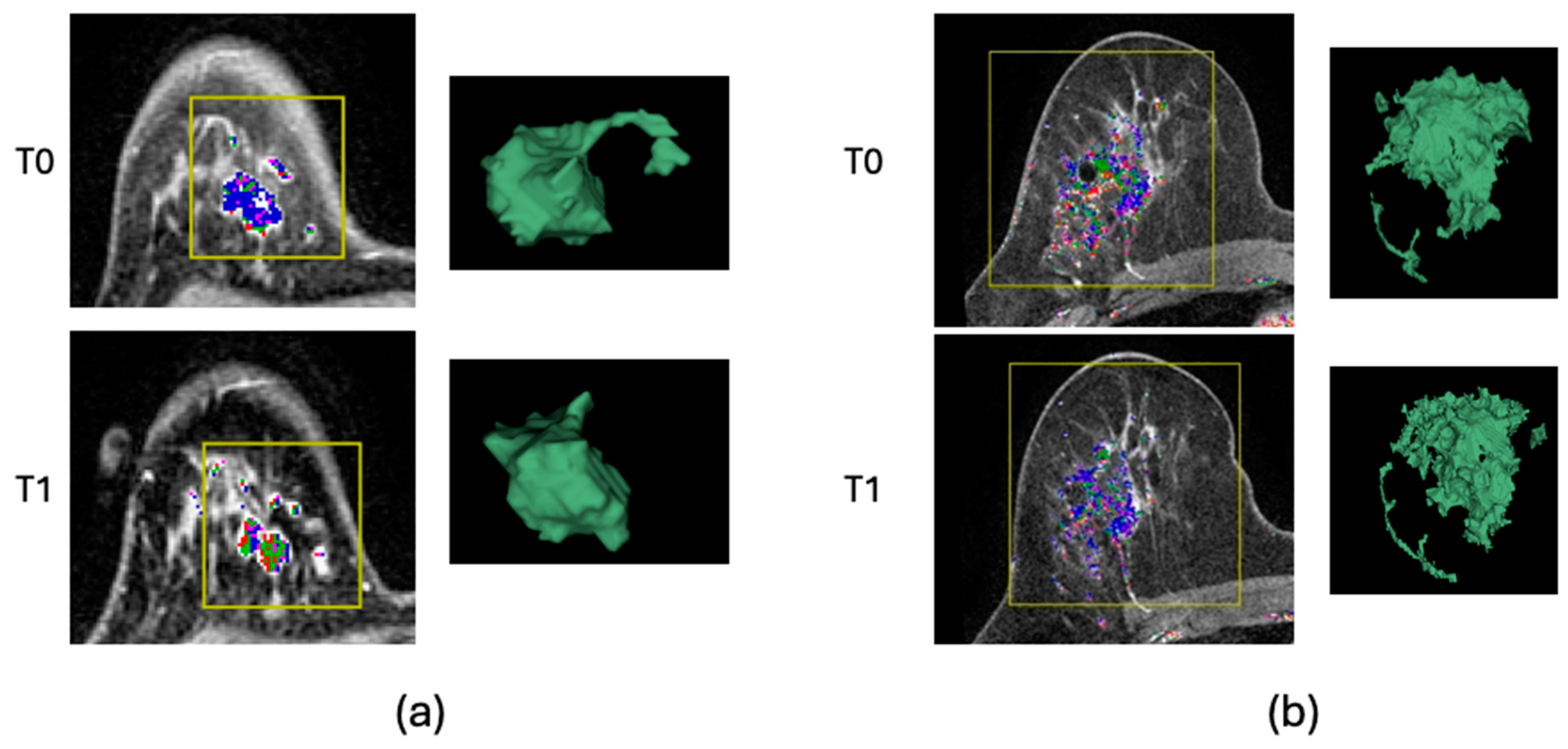 Tomography 10 00134 g006 Tomography 10 00134 g006