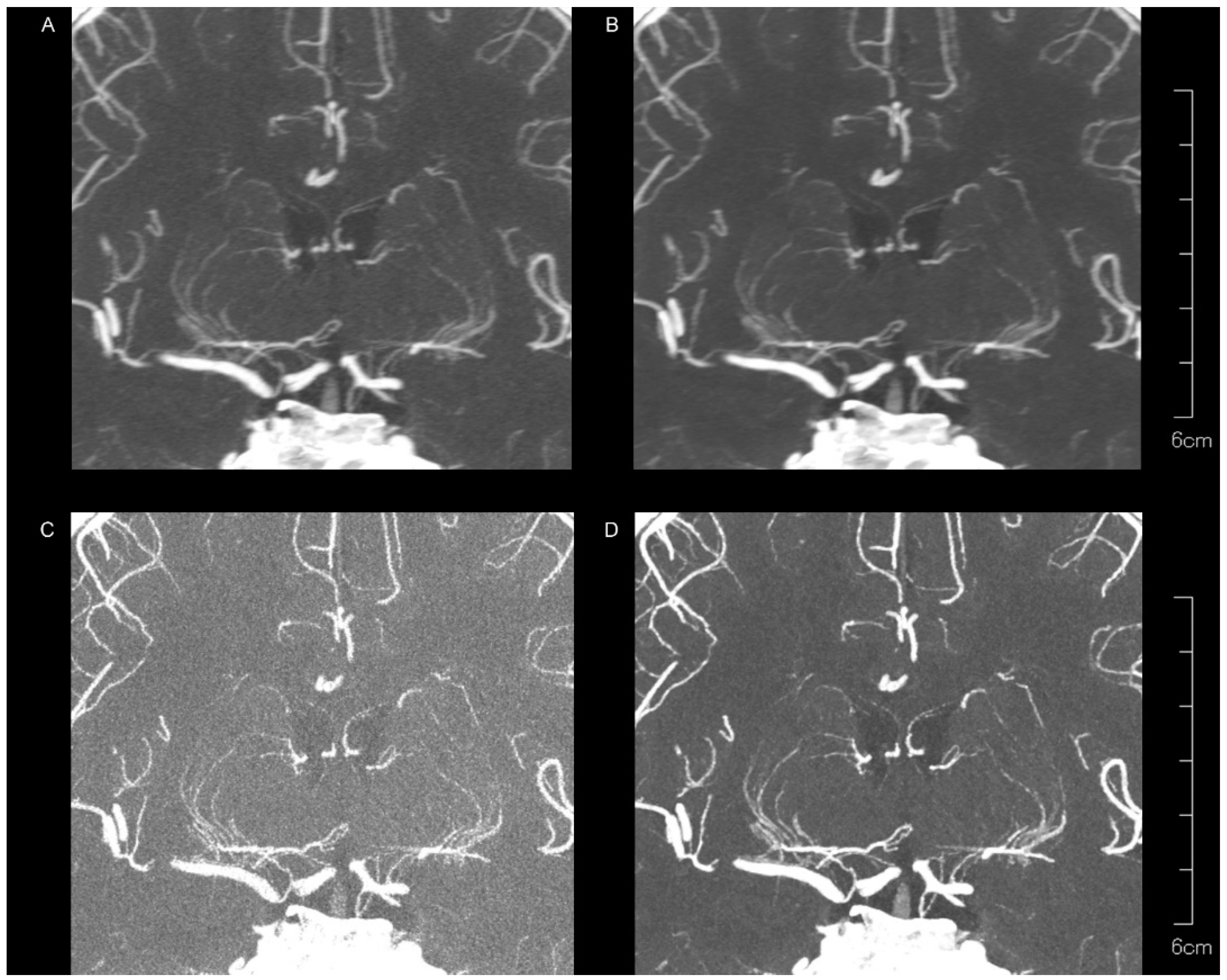 Tomography 10 00136 g003