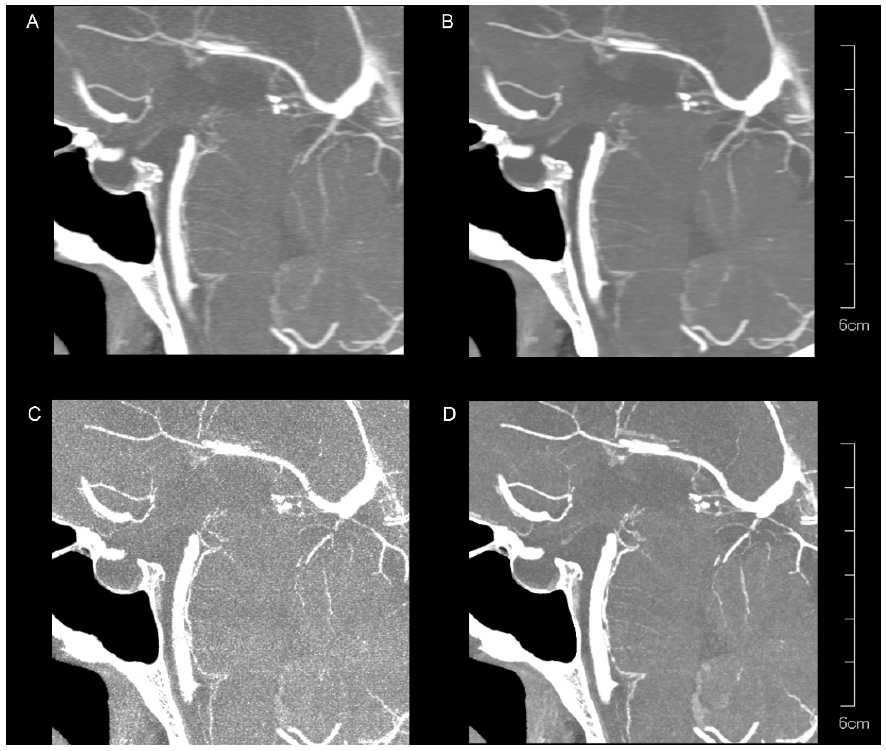 Tomography 10 00136 g004