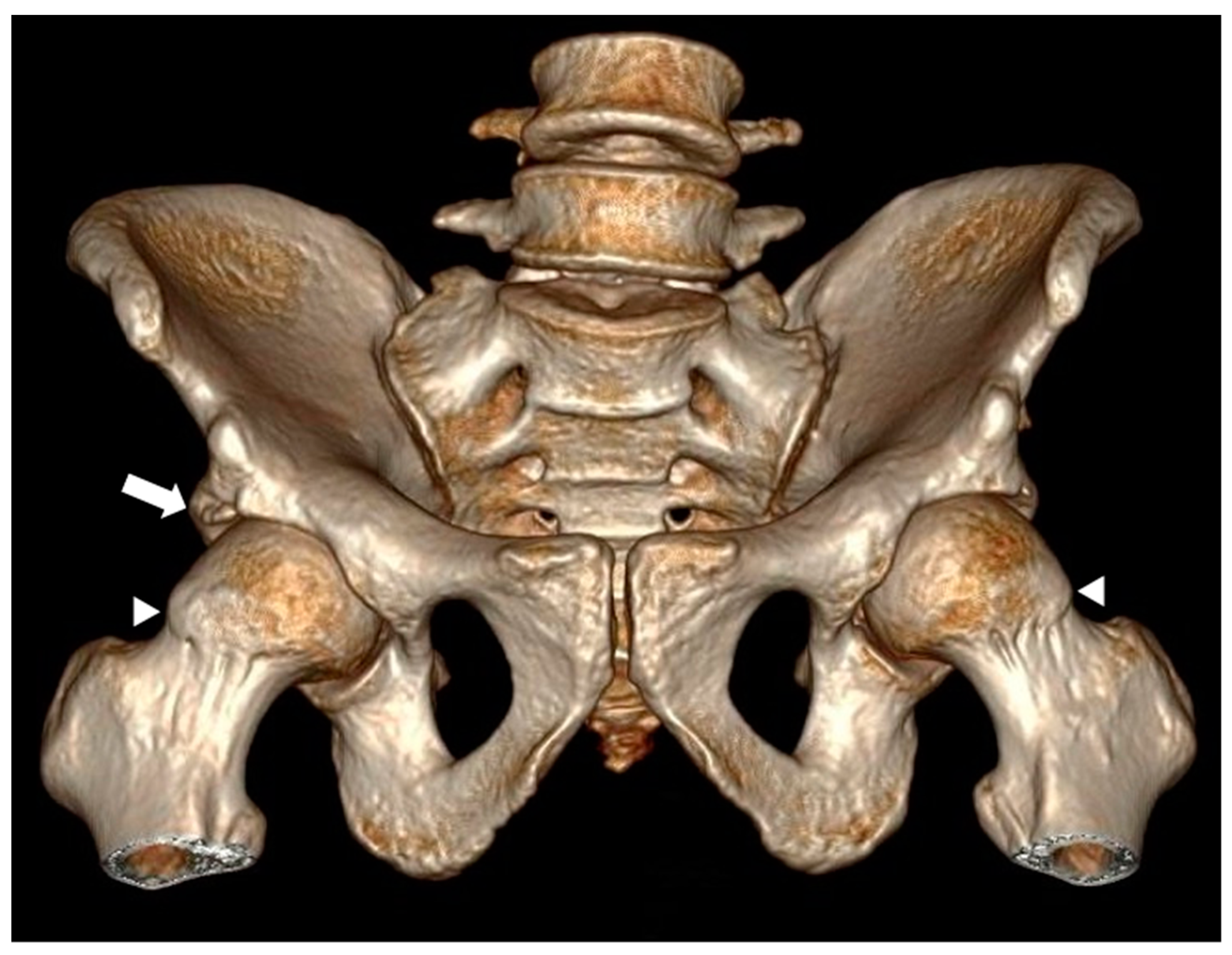 Tomography 10 00141 g001