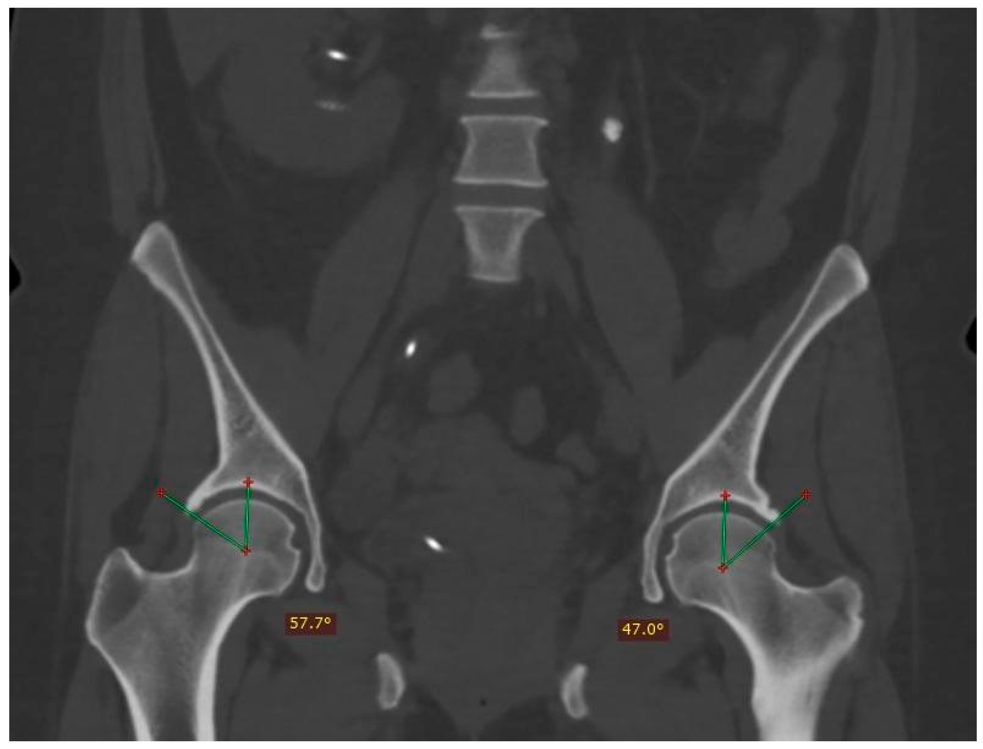 Tomography 10 00141 g002