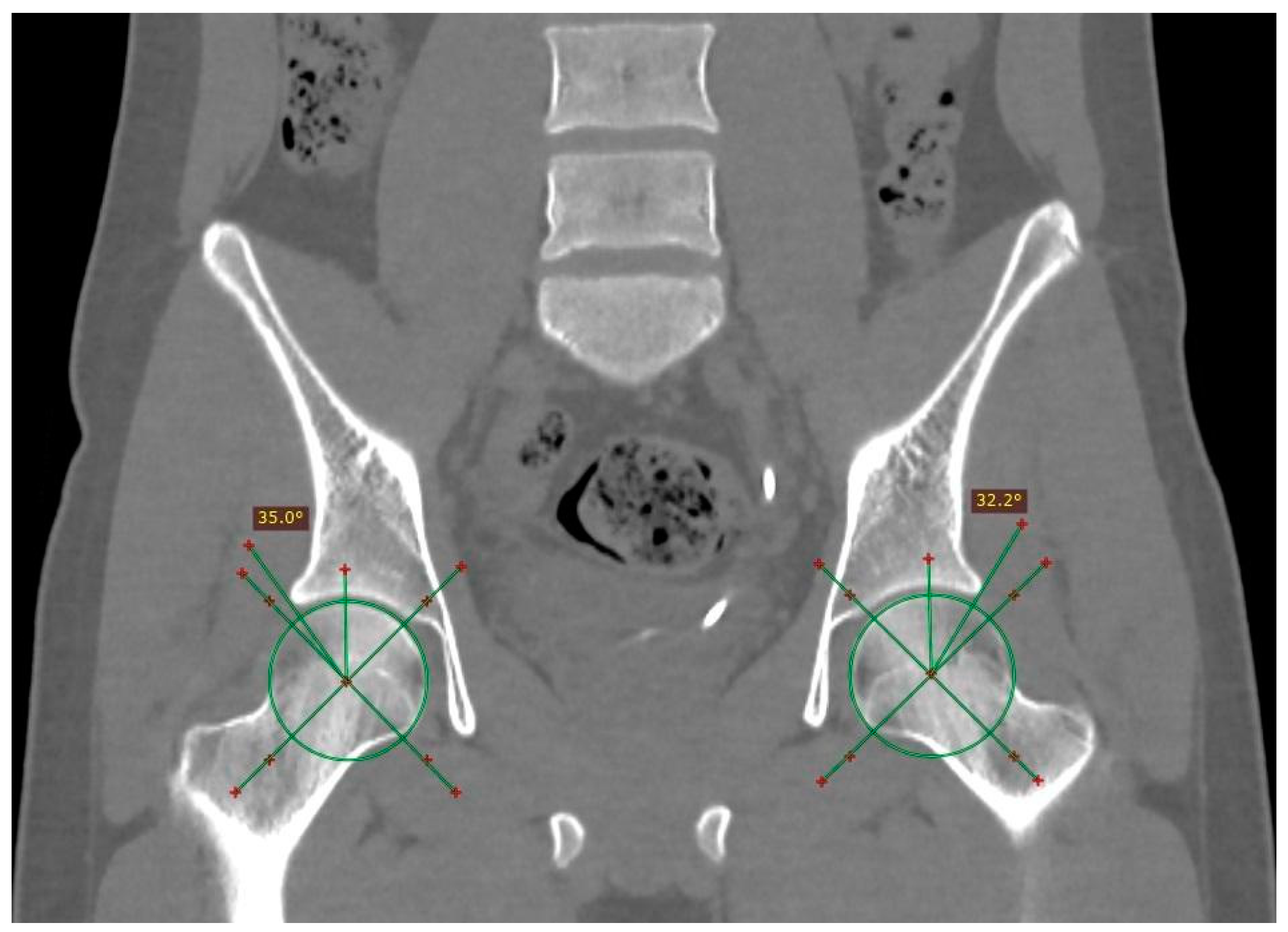 Tomography 10 00141 g003