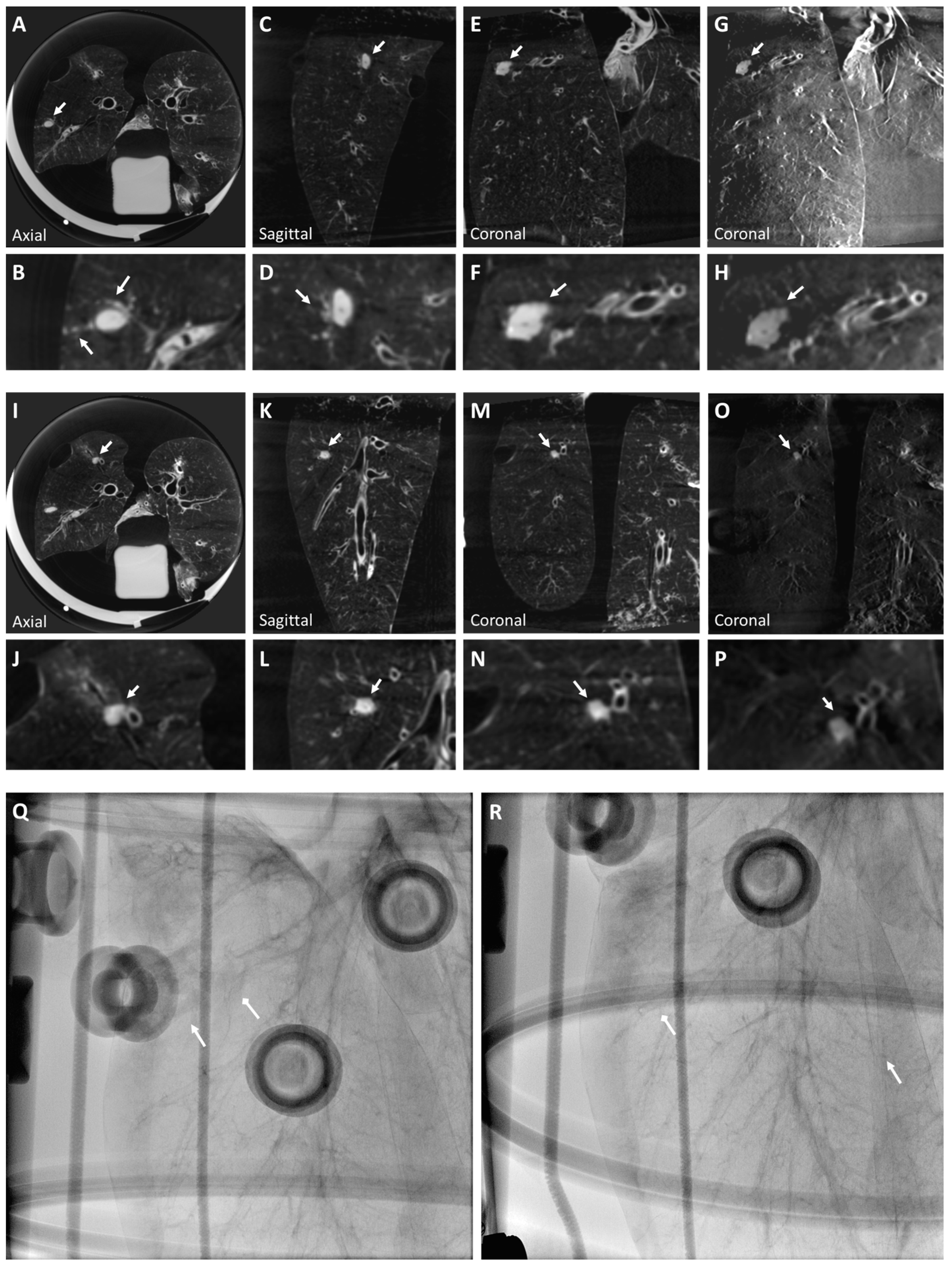 Tomography 10 00142 g002