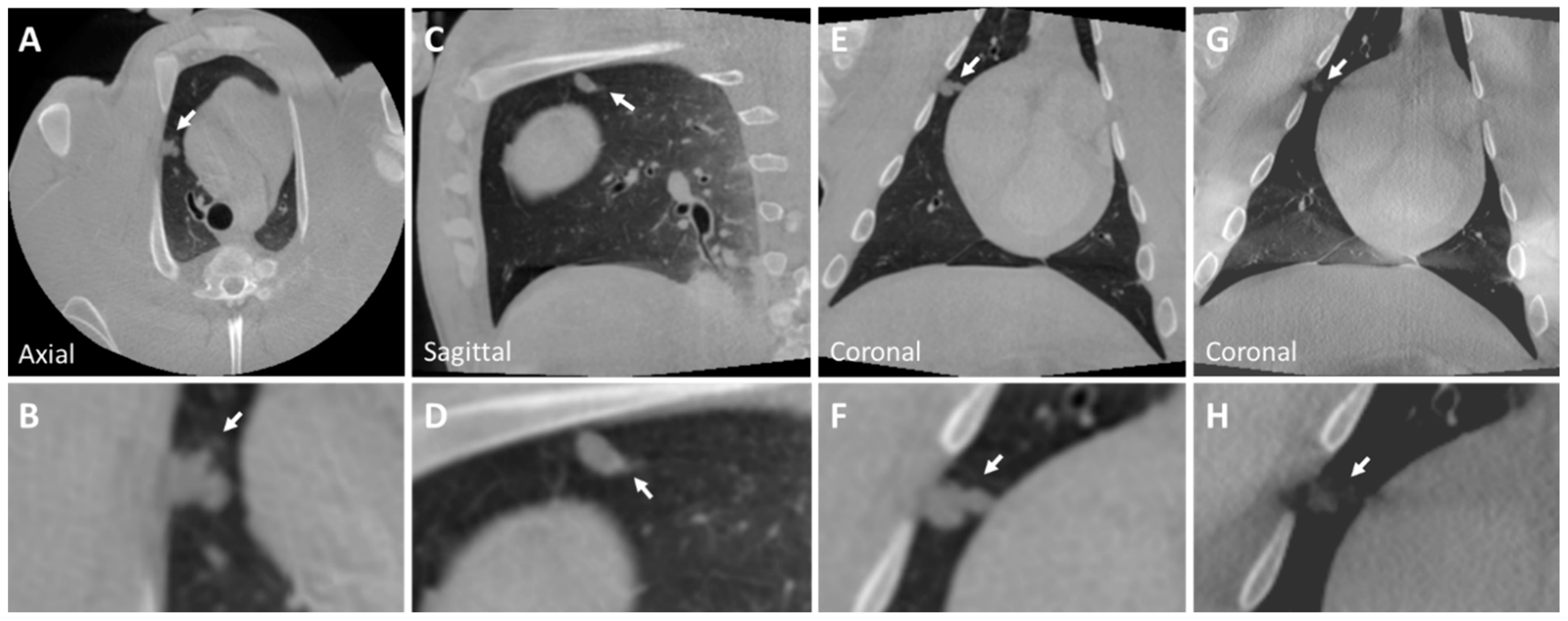 Tomography 10 00142 g003