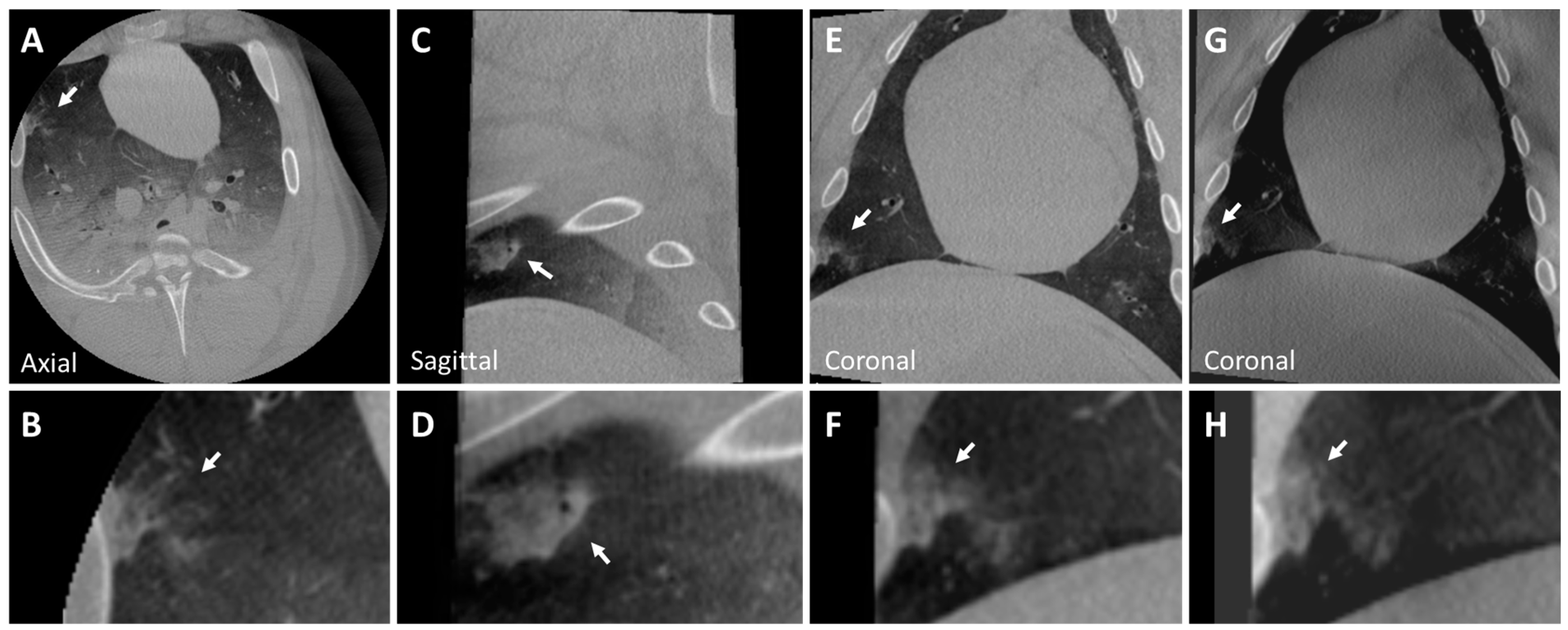 Tomography 10 00142 g005