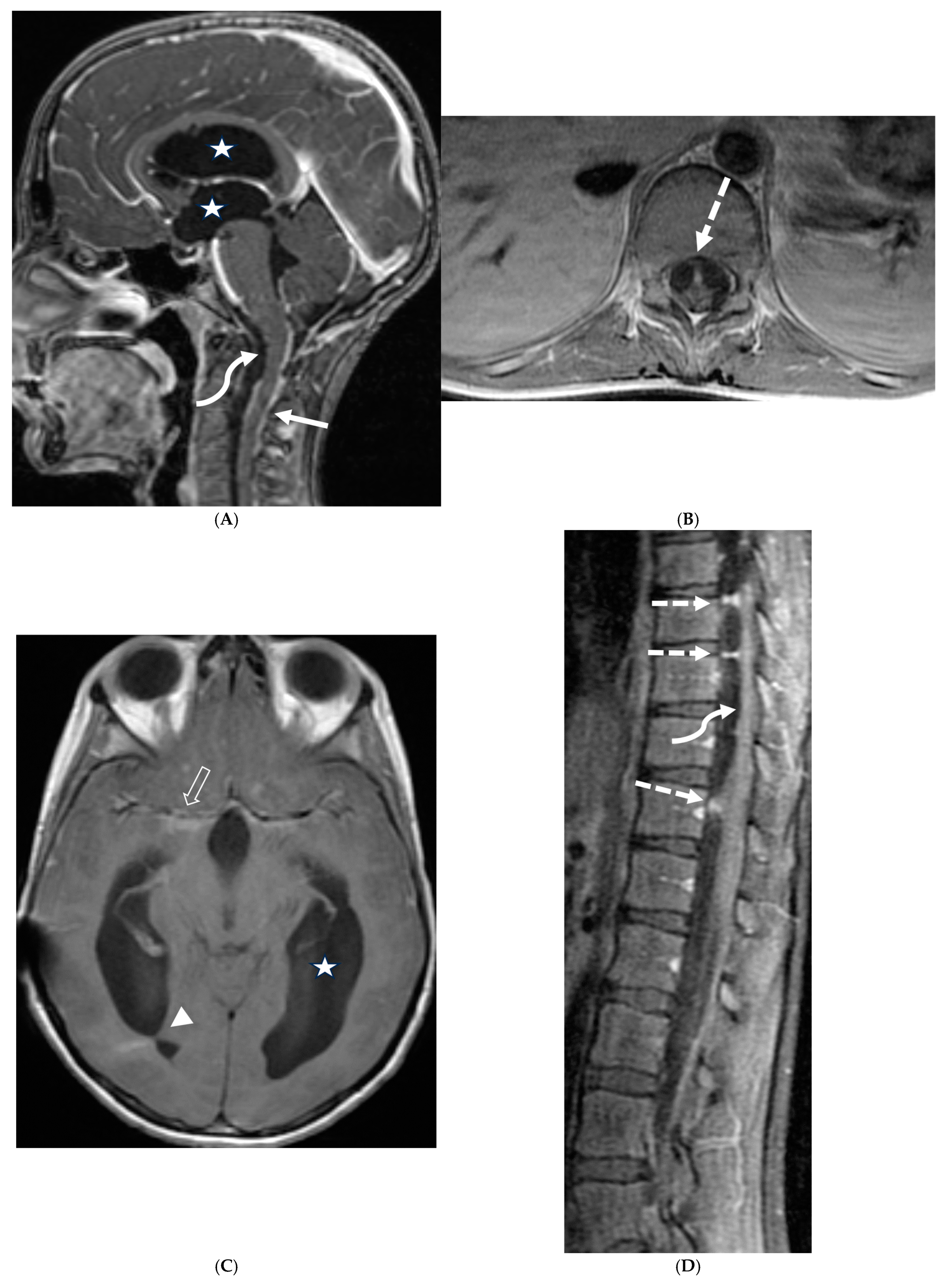 Tomography 10 00143 g002