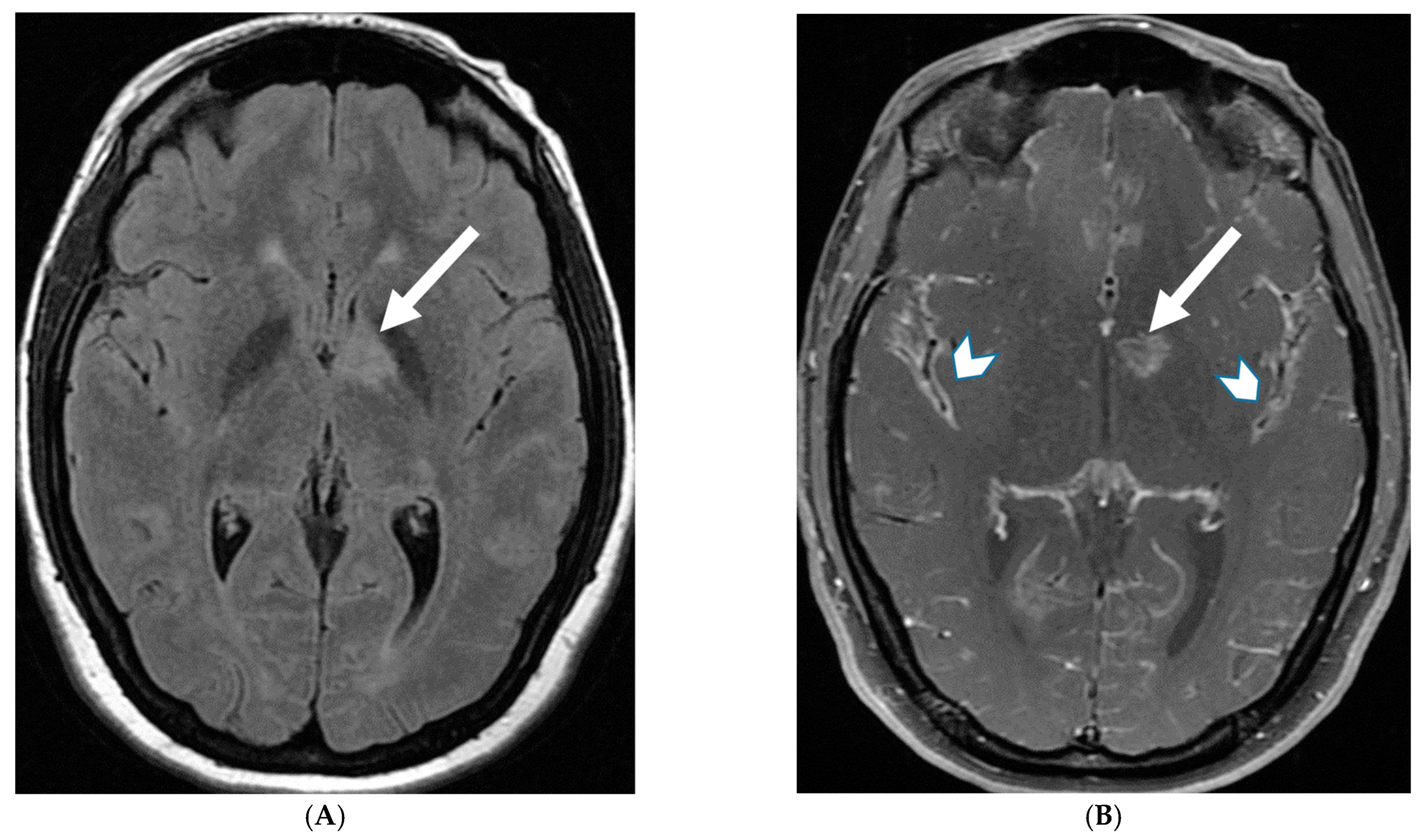 Tomography 10 00143 g003a