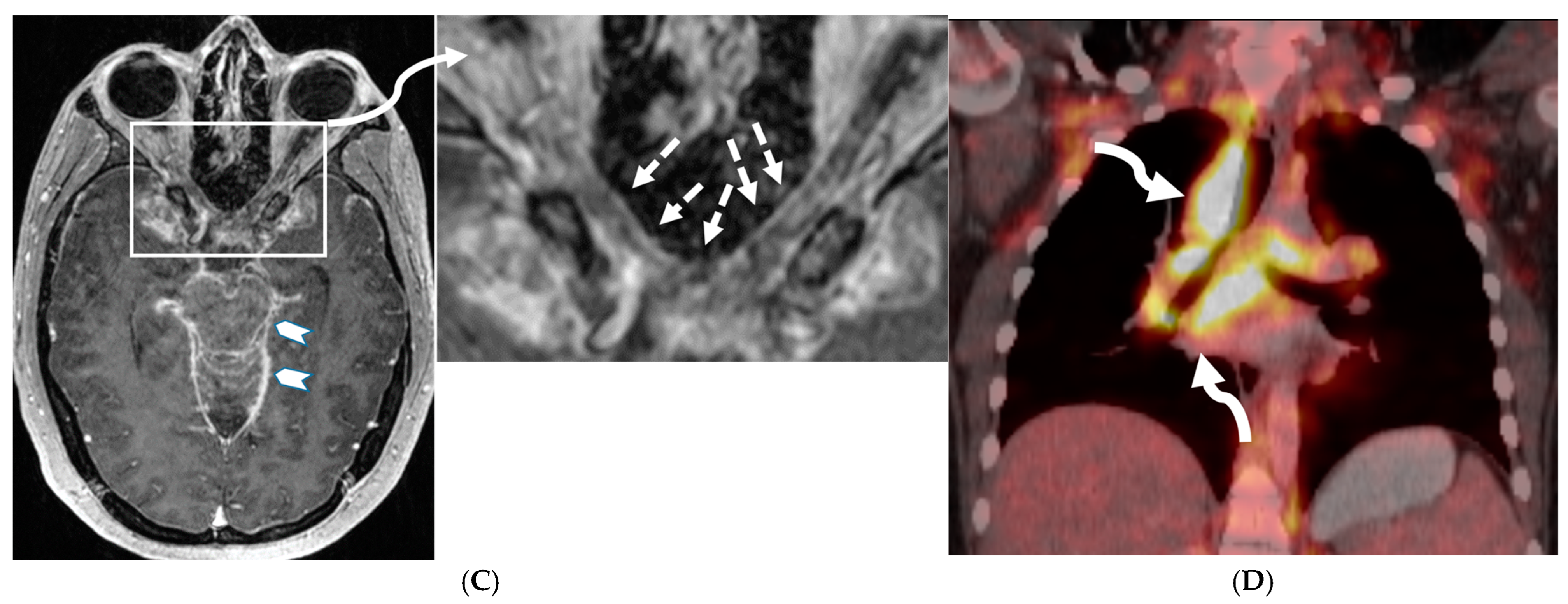 Tomography 10 00143 g003b