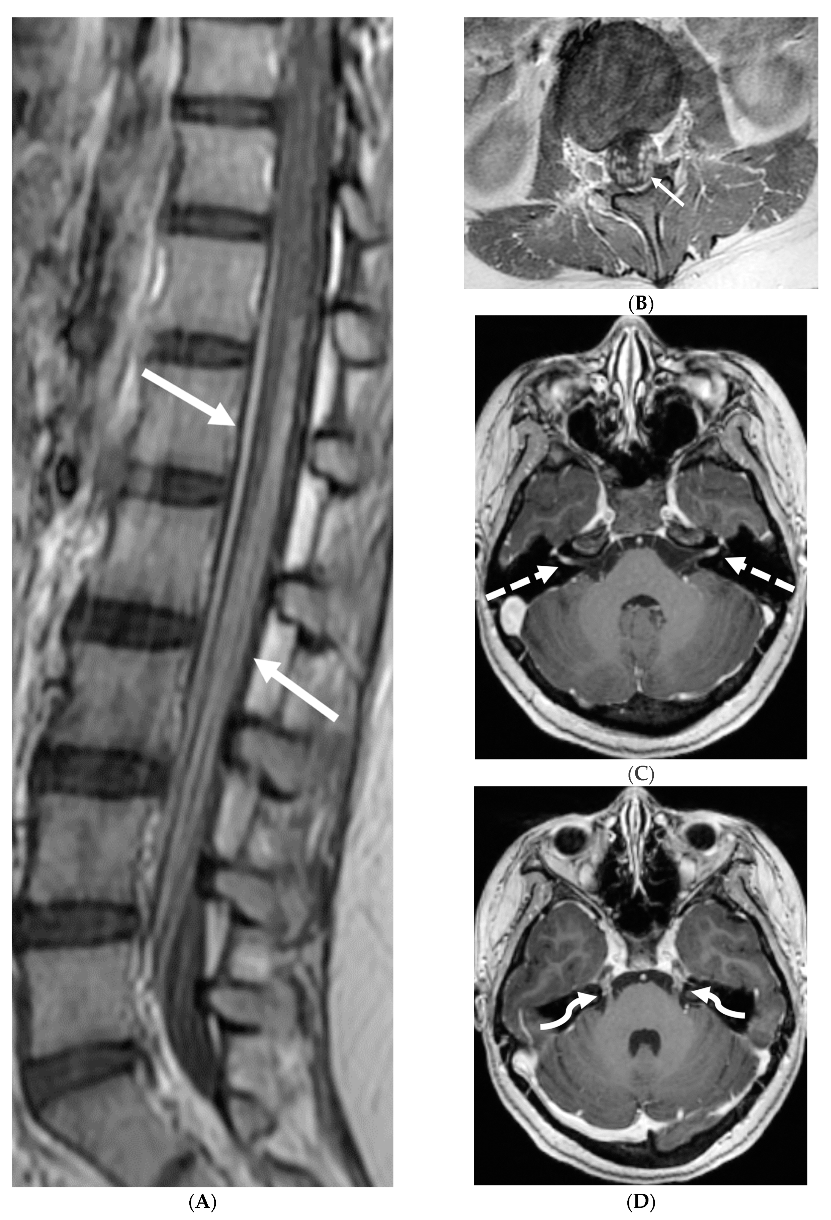 Tomography 10 00143 g004
