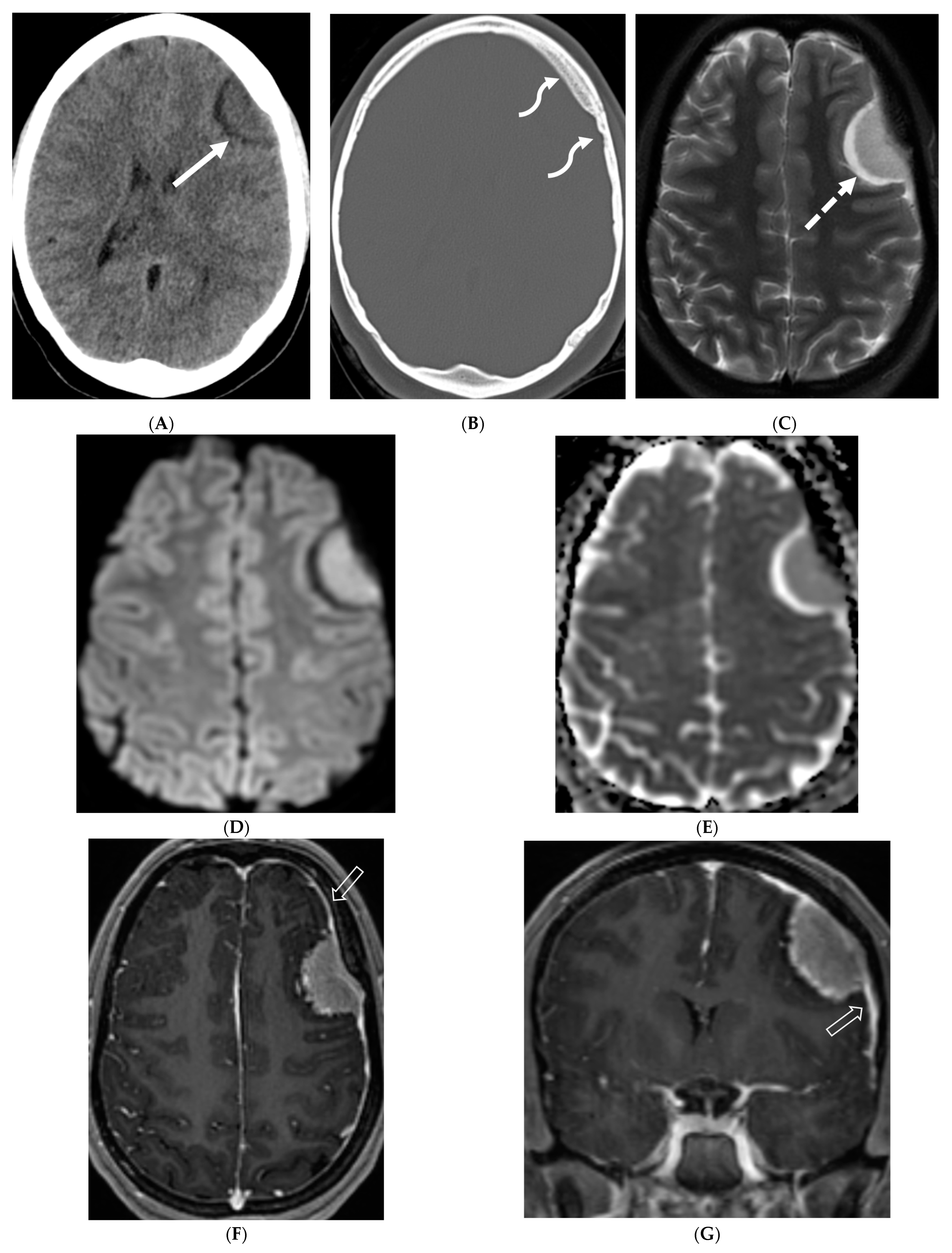 Tomography 10 00143 g005