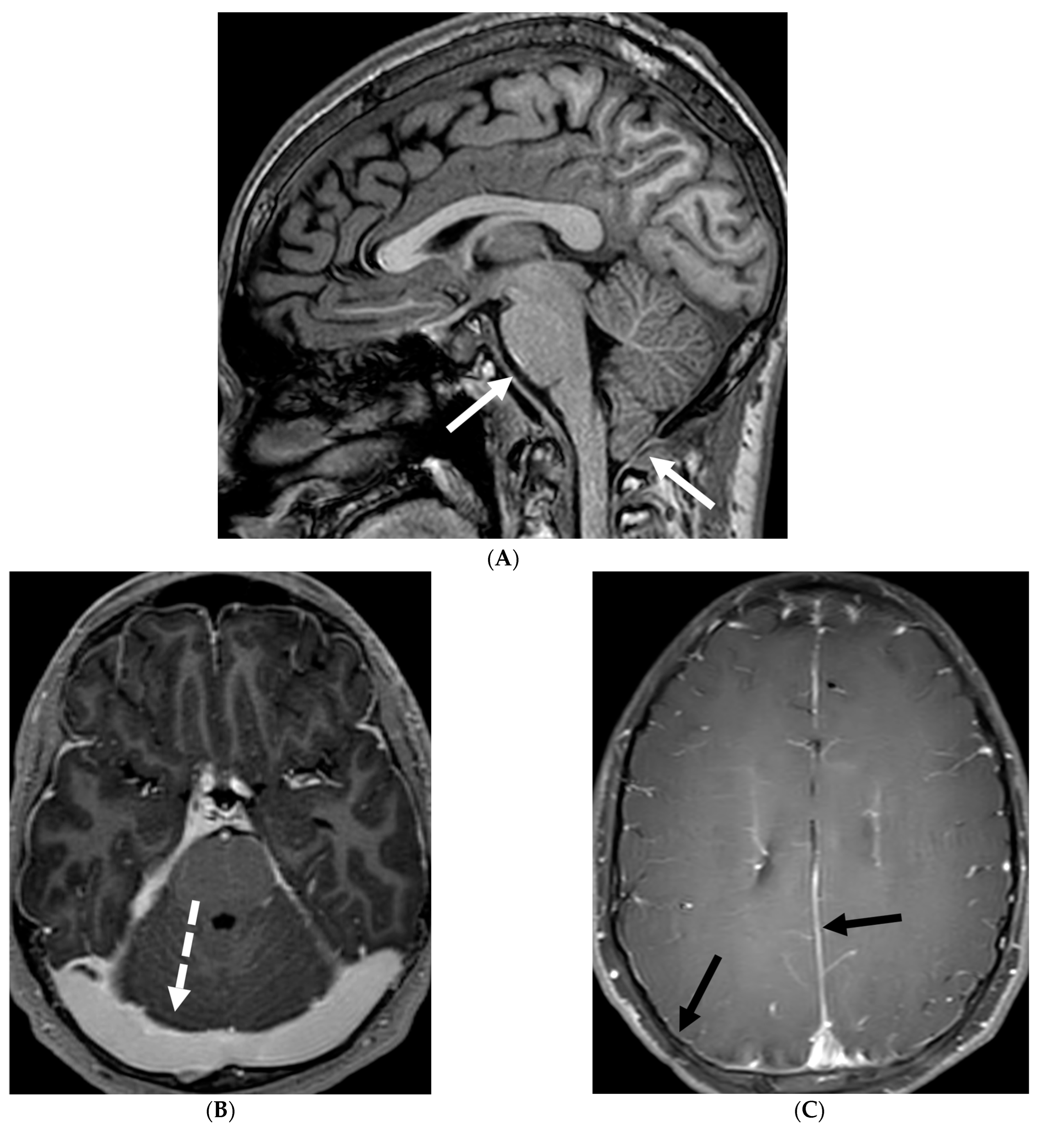Tomography 10 00143 g008a
