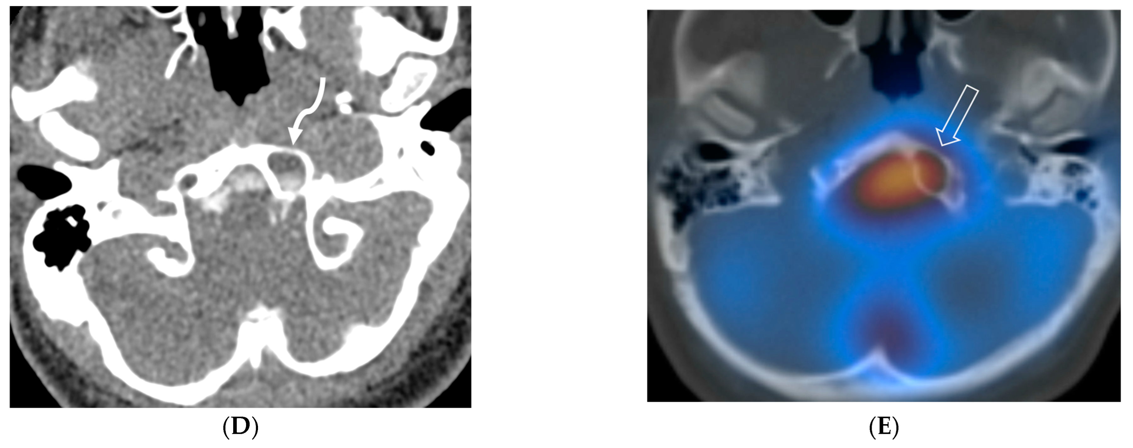 Tomography 10 00143 g008b