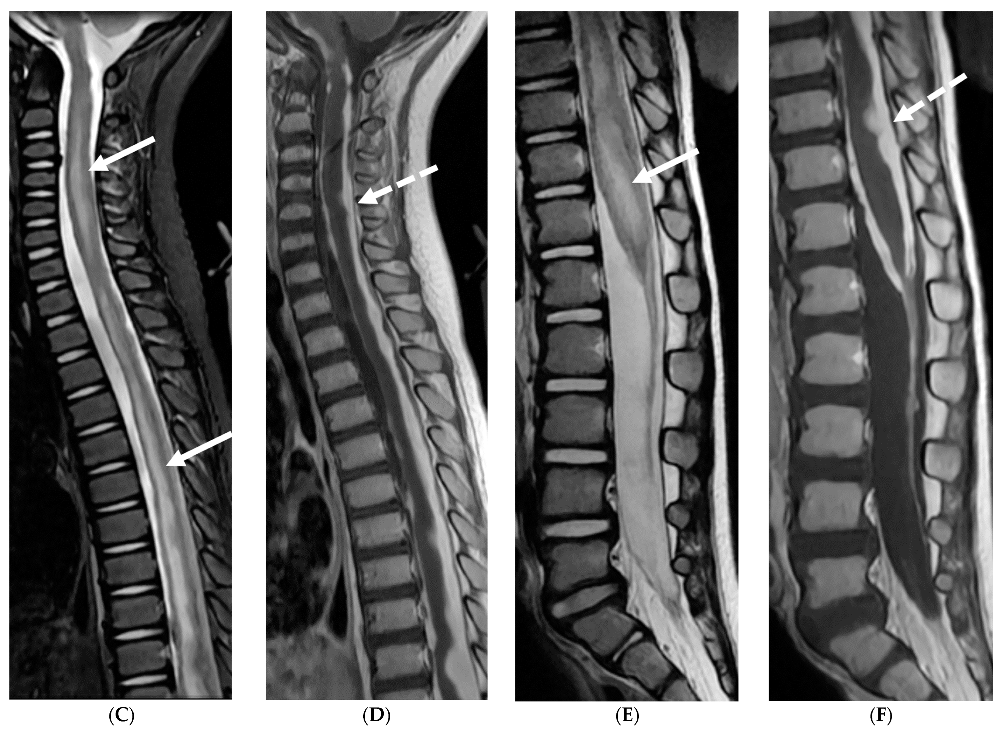 Tomography 10 00143 g010b