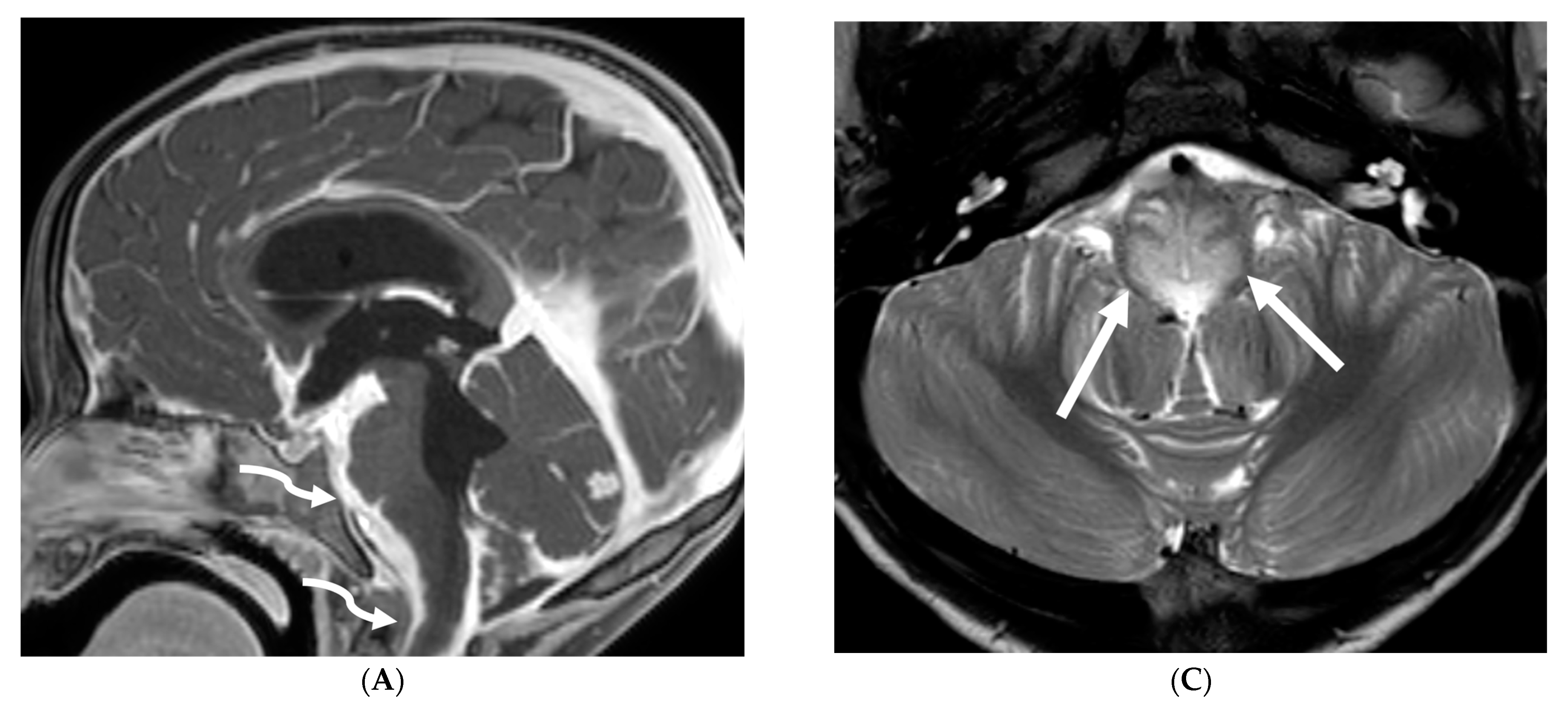 Tomography 10 00143 g011a