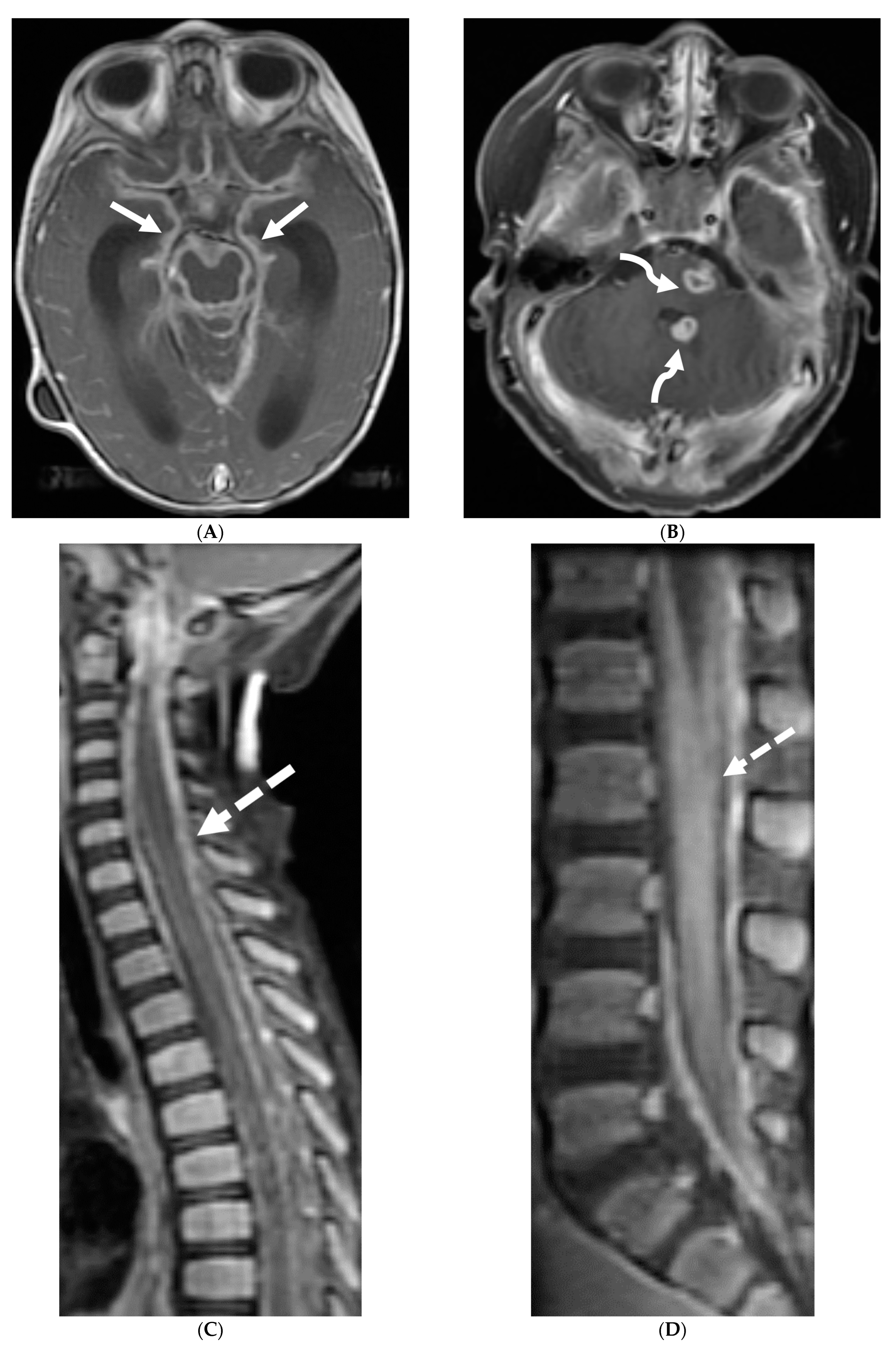 Tomography 10 00143 g013