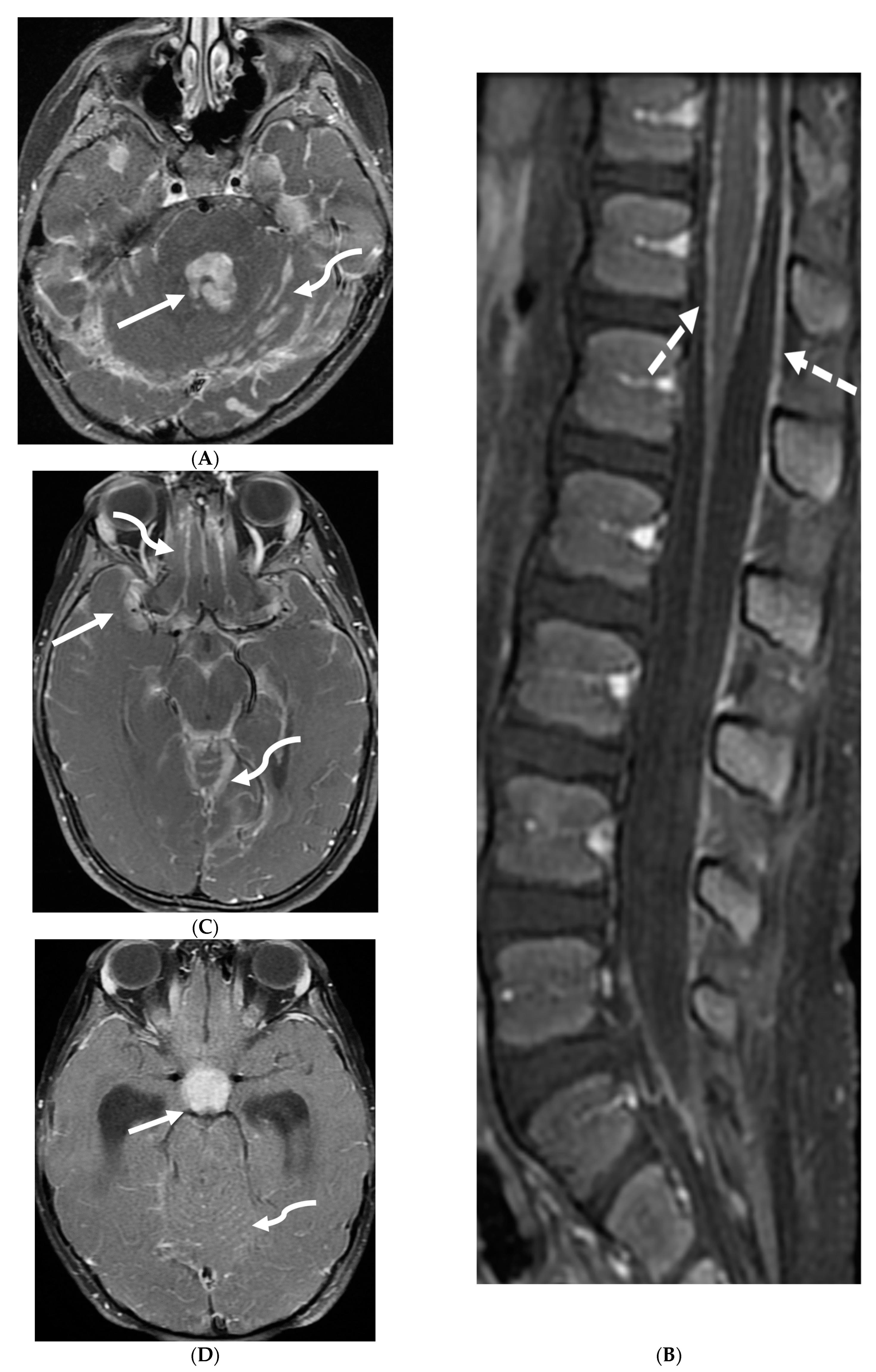 Tomography 10 00143 g014