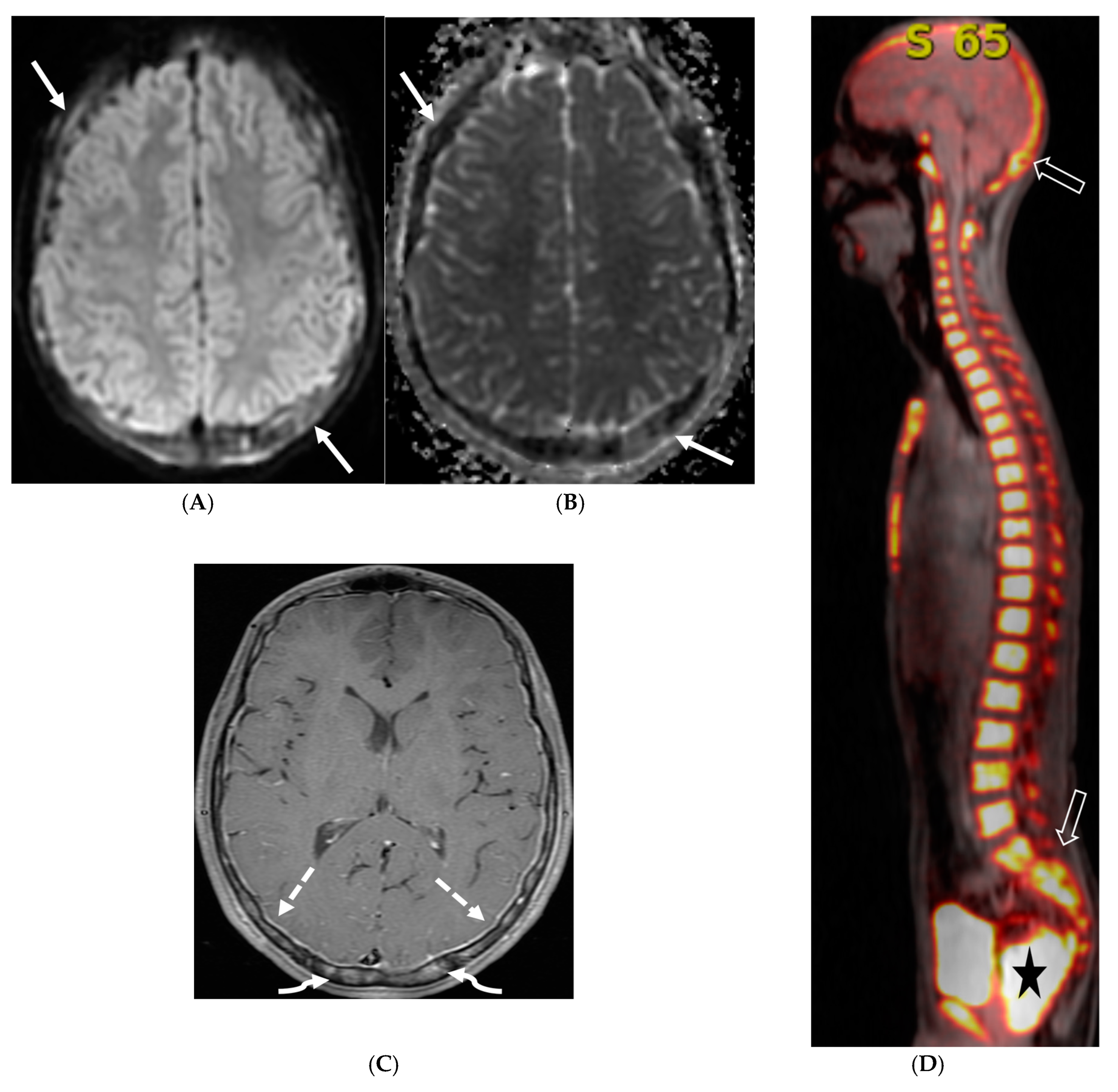 Tomography 10 00143 g015