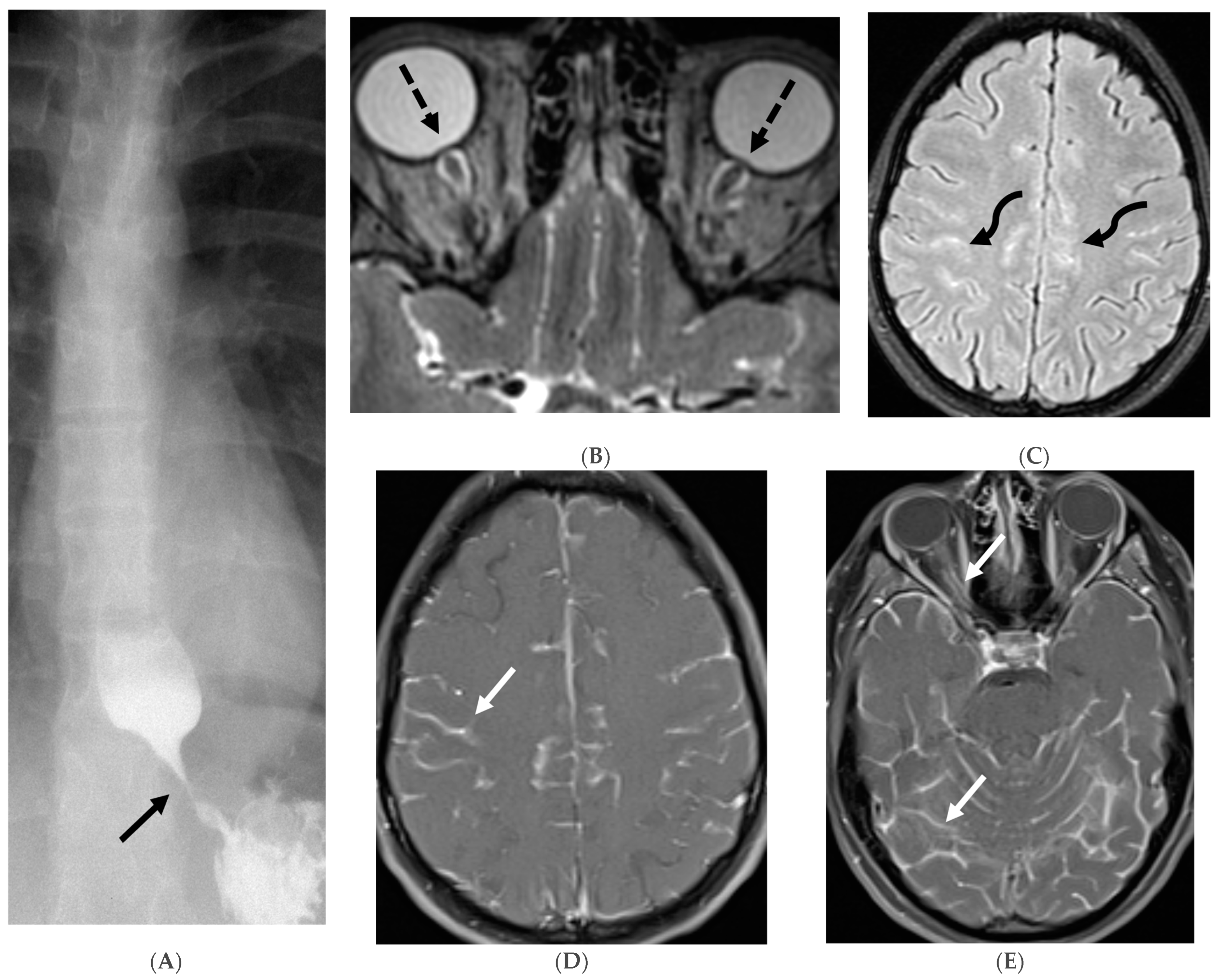 Tomography 10 00143 g016