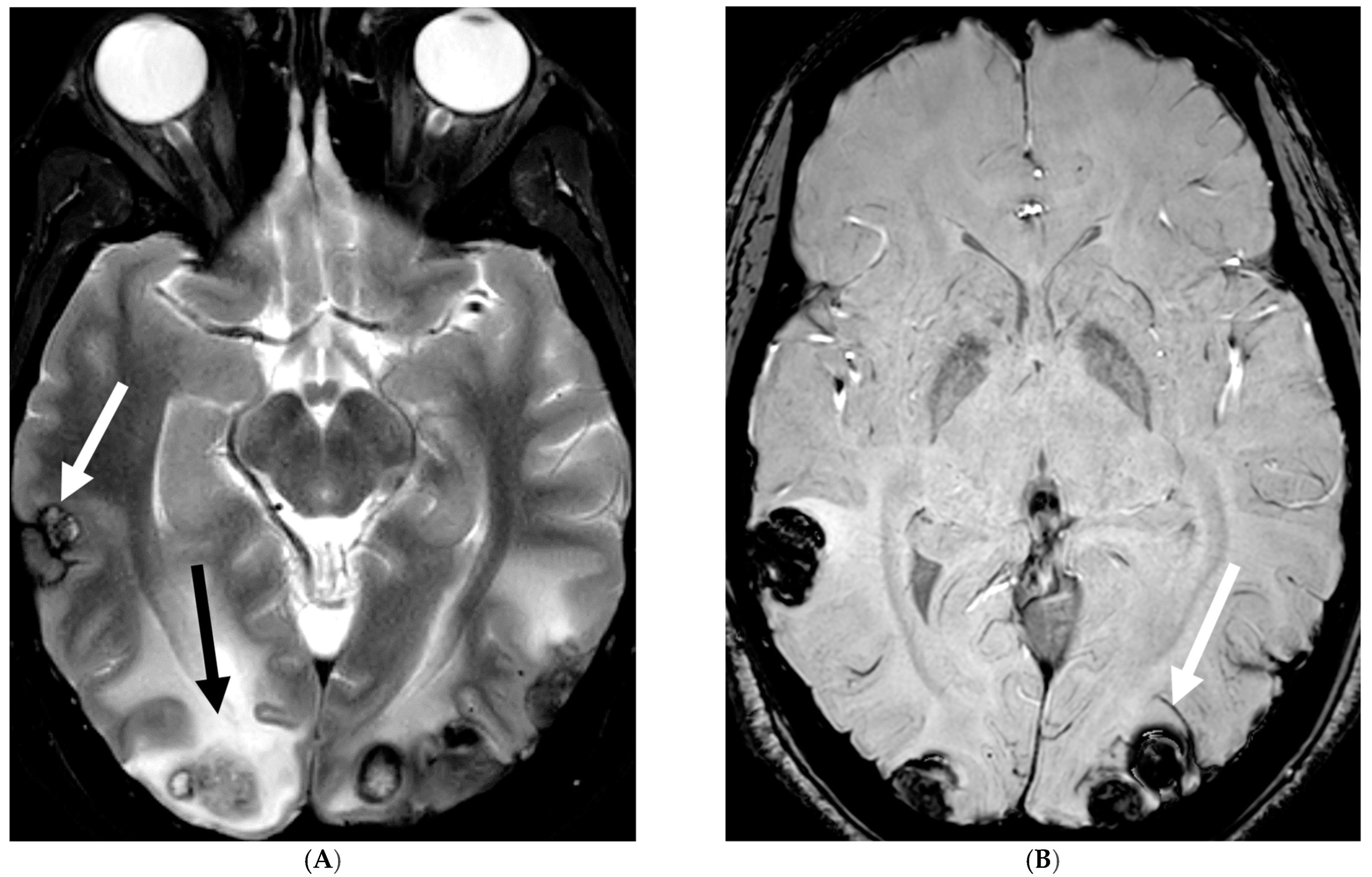 Tomography 10 00143 g017a