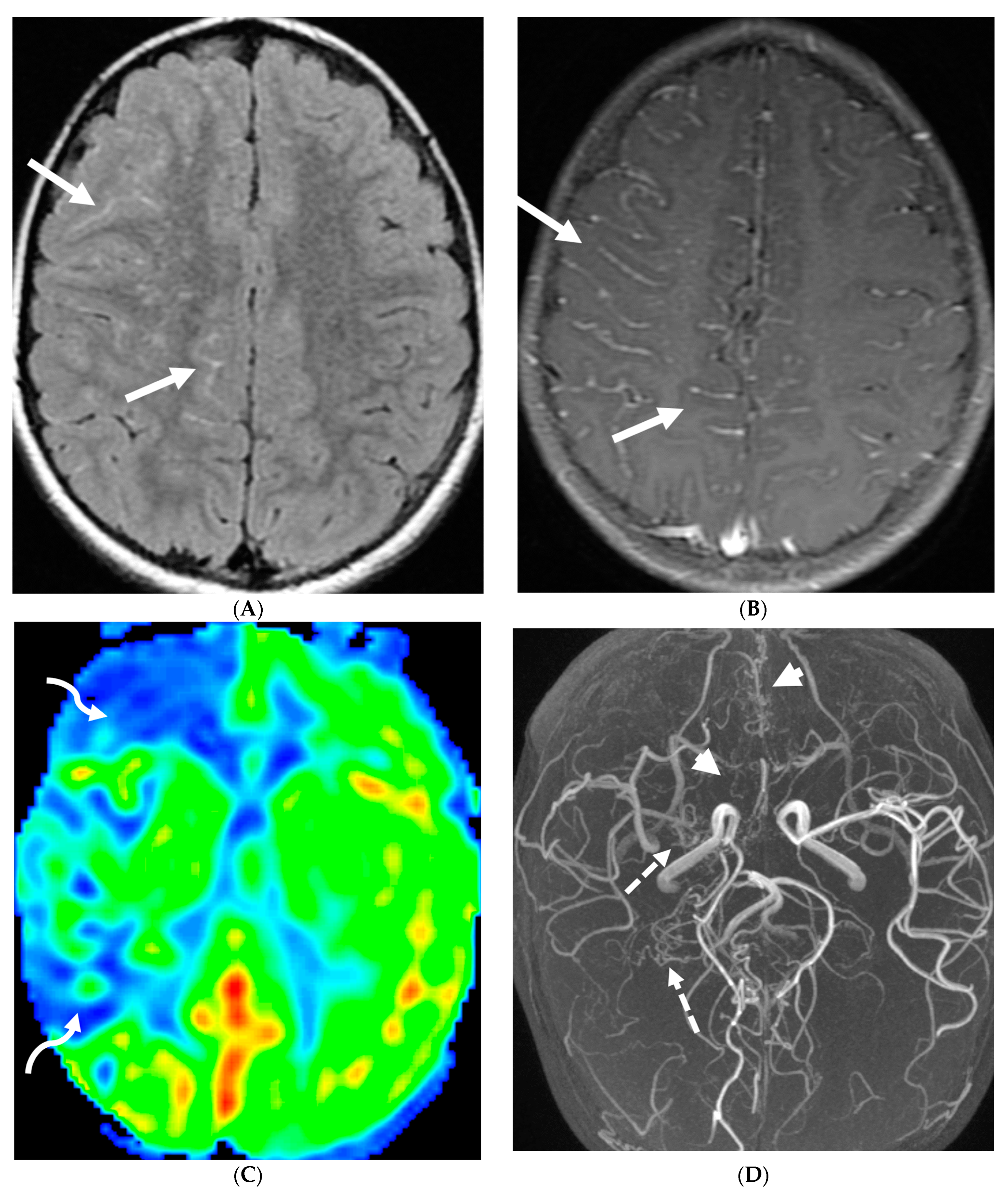 Tomography 10 00143 g018