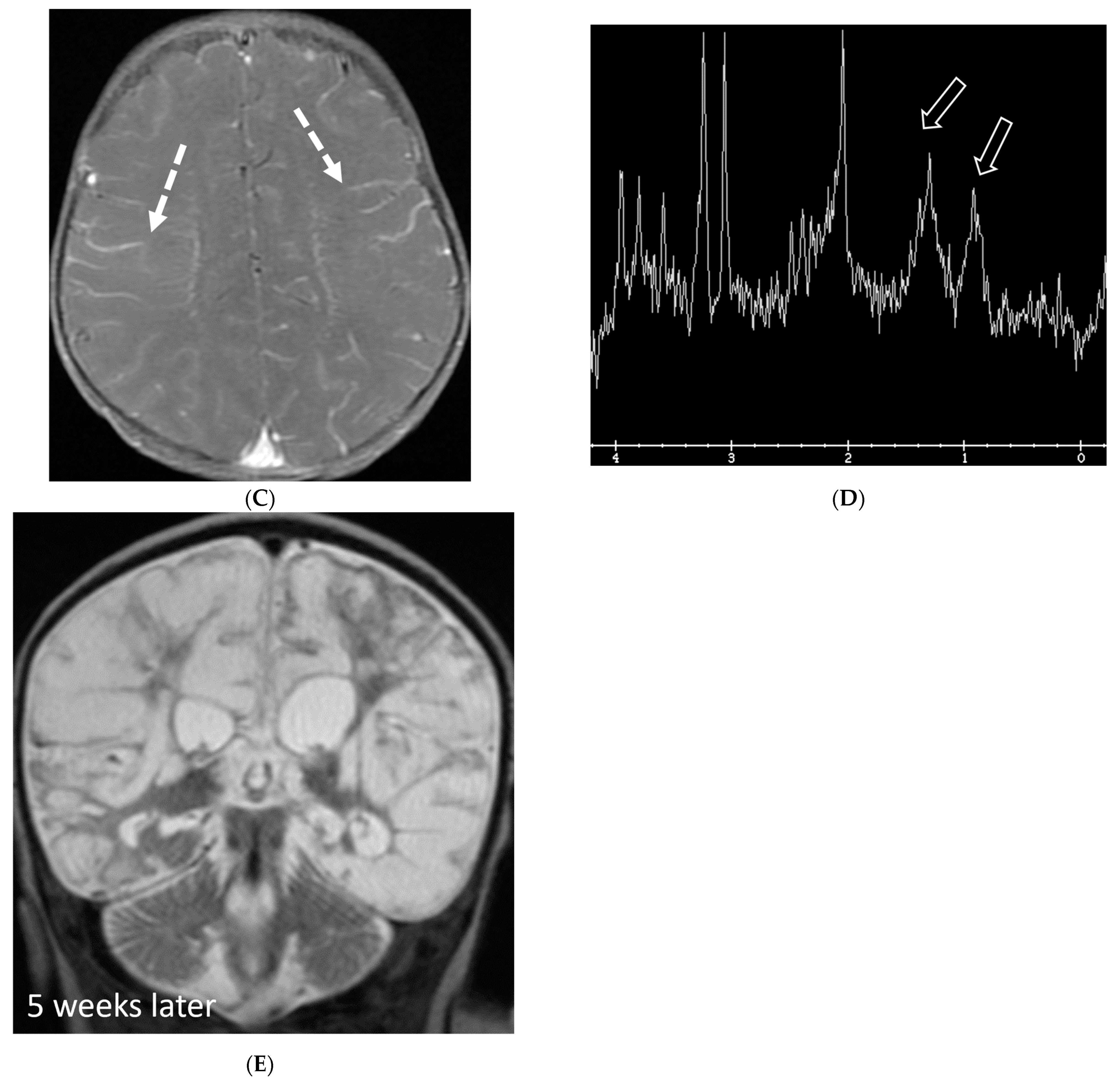 Tomography 10 00143 g019b