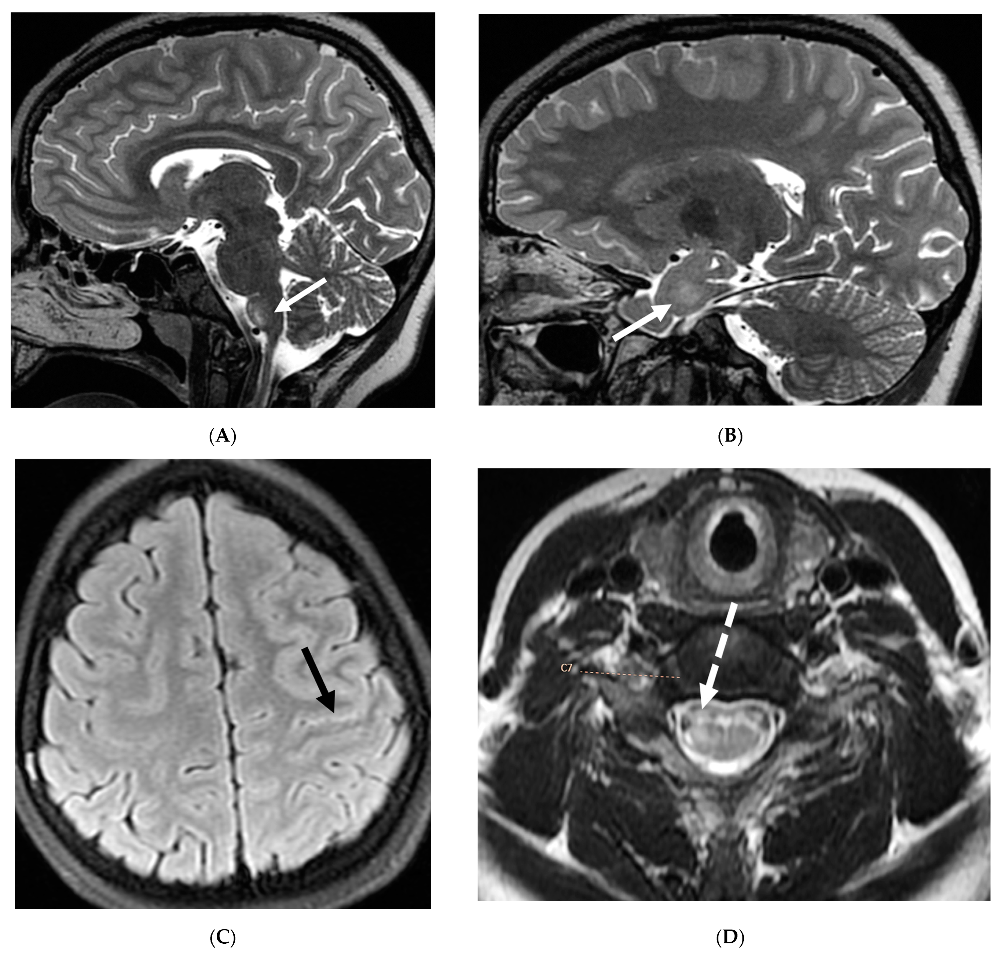 Tomography 10 00143 g021a