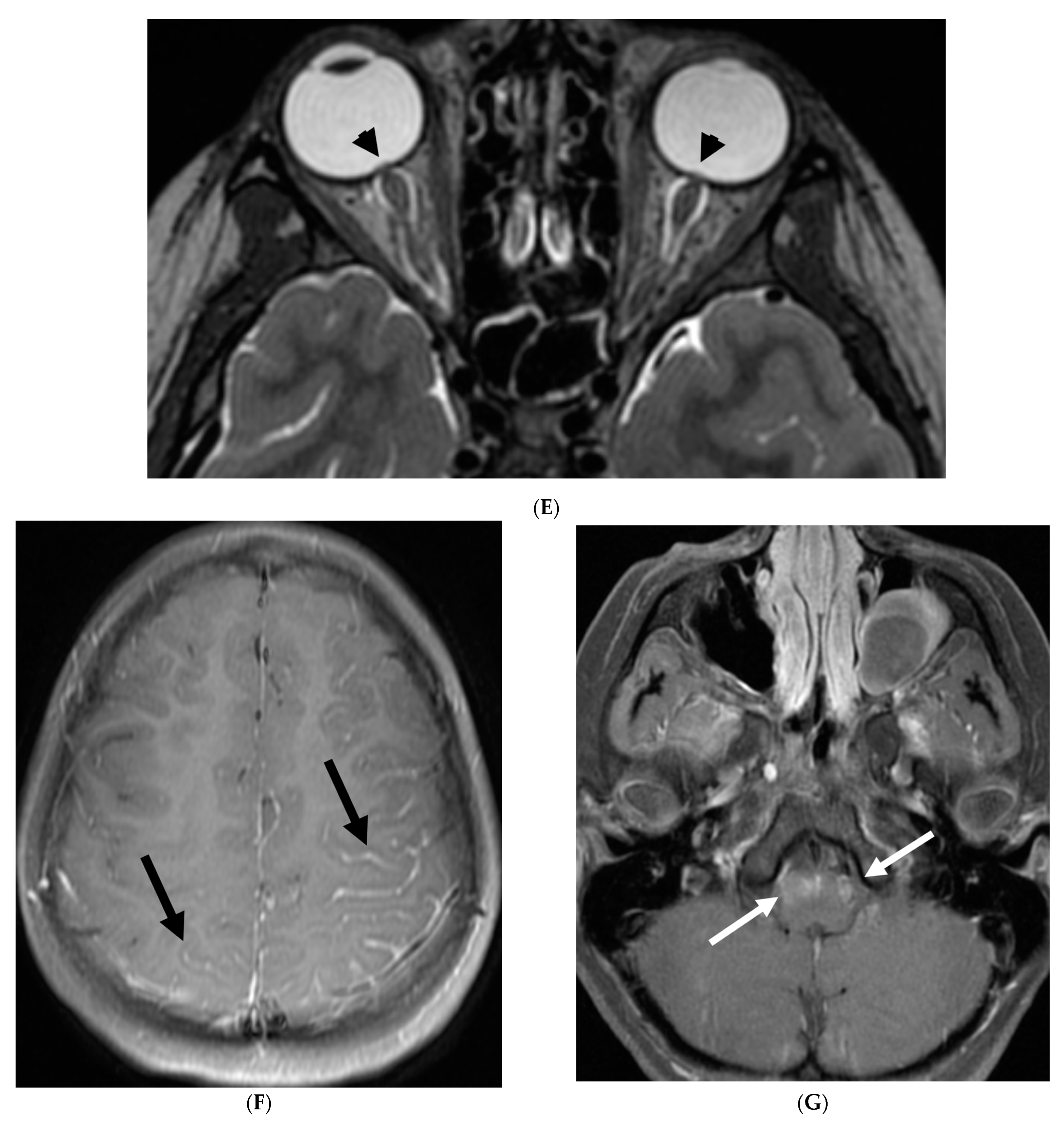 Tomography 10 00143 g021b
