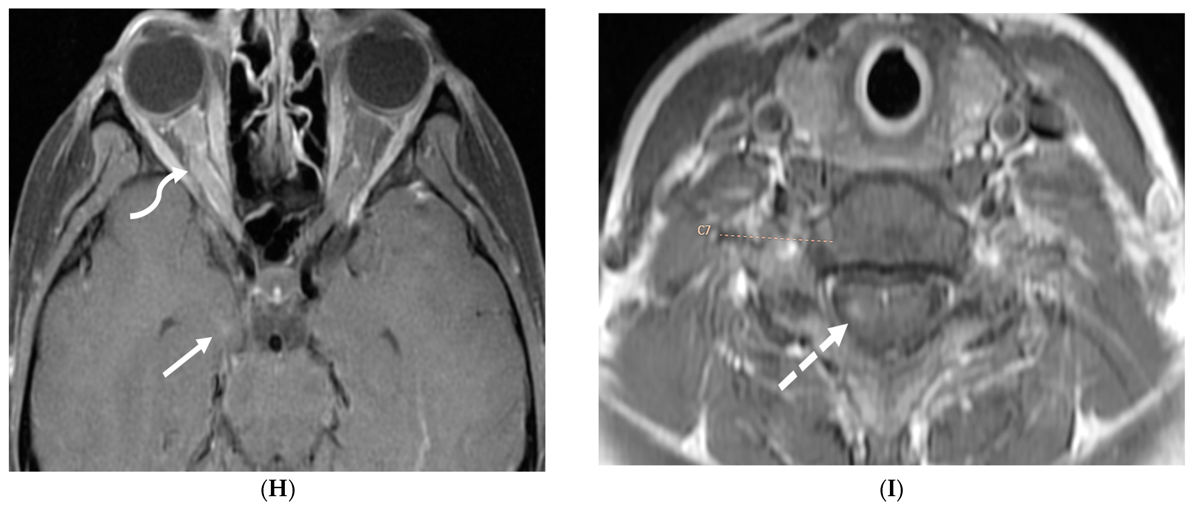 Tomography 10 00143 g021c