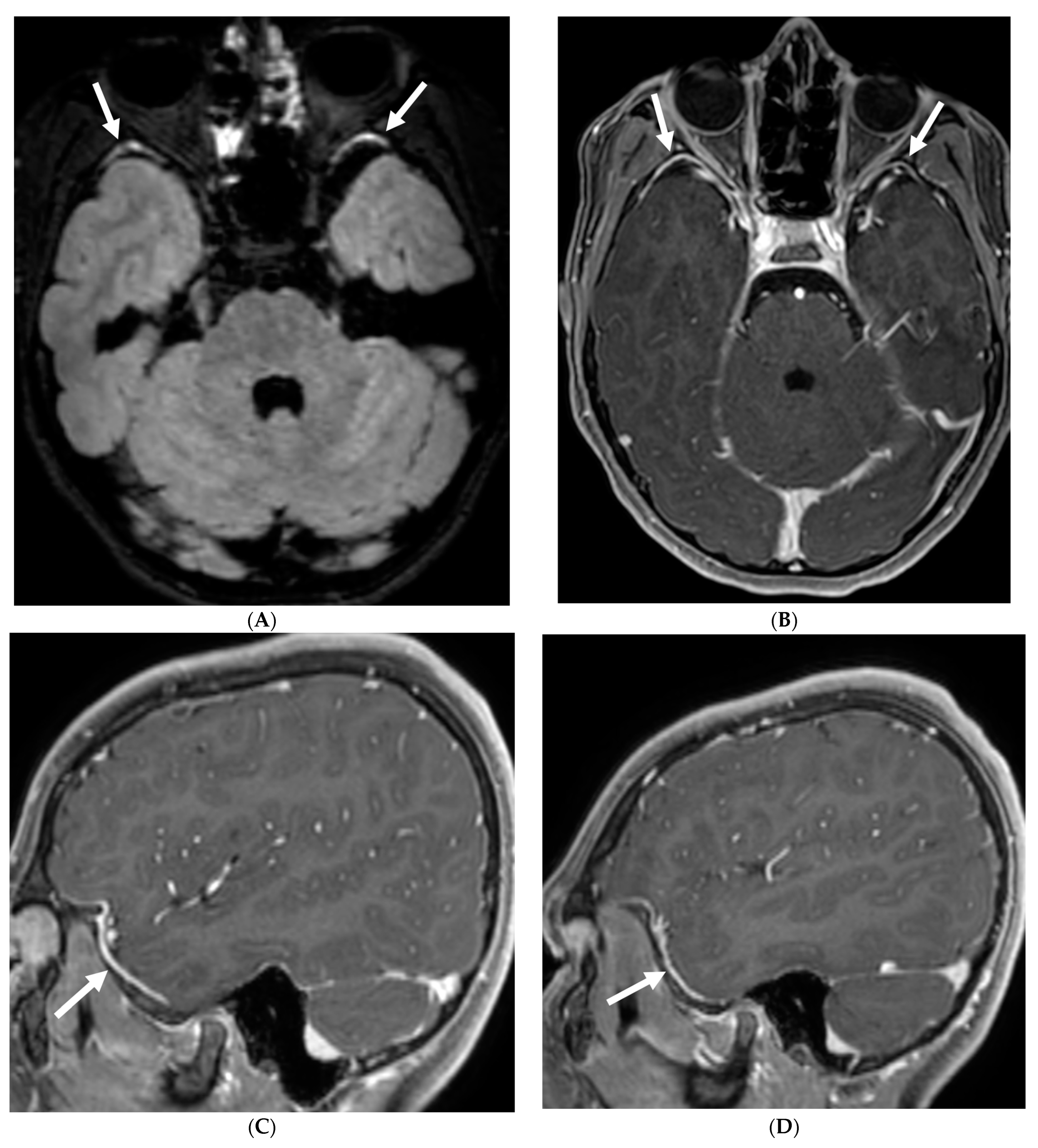 Tomography 10 00143 g022