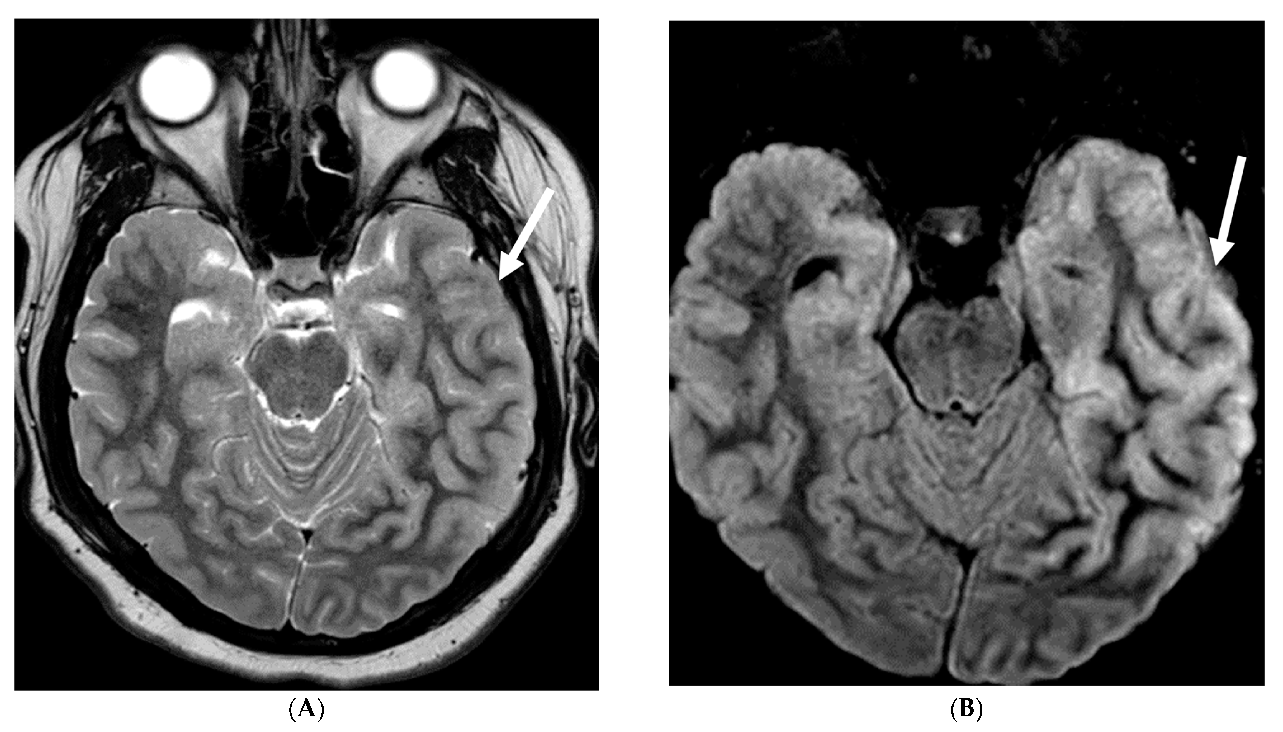 Tomography 10 00143 g023a