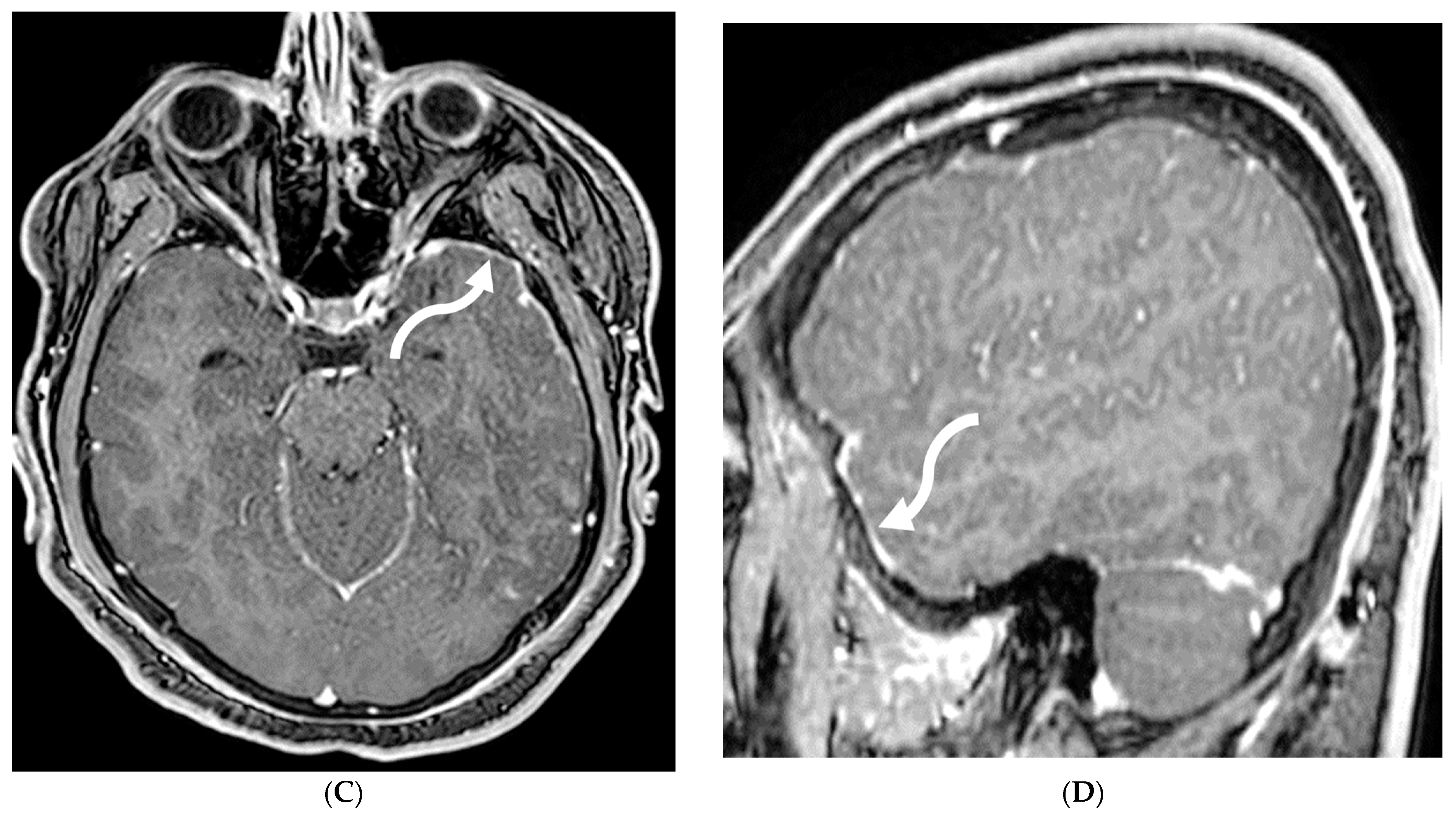 Tomography 10 00143 g023b