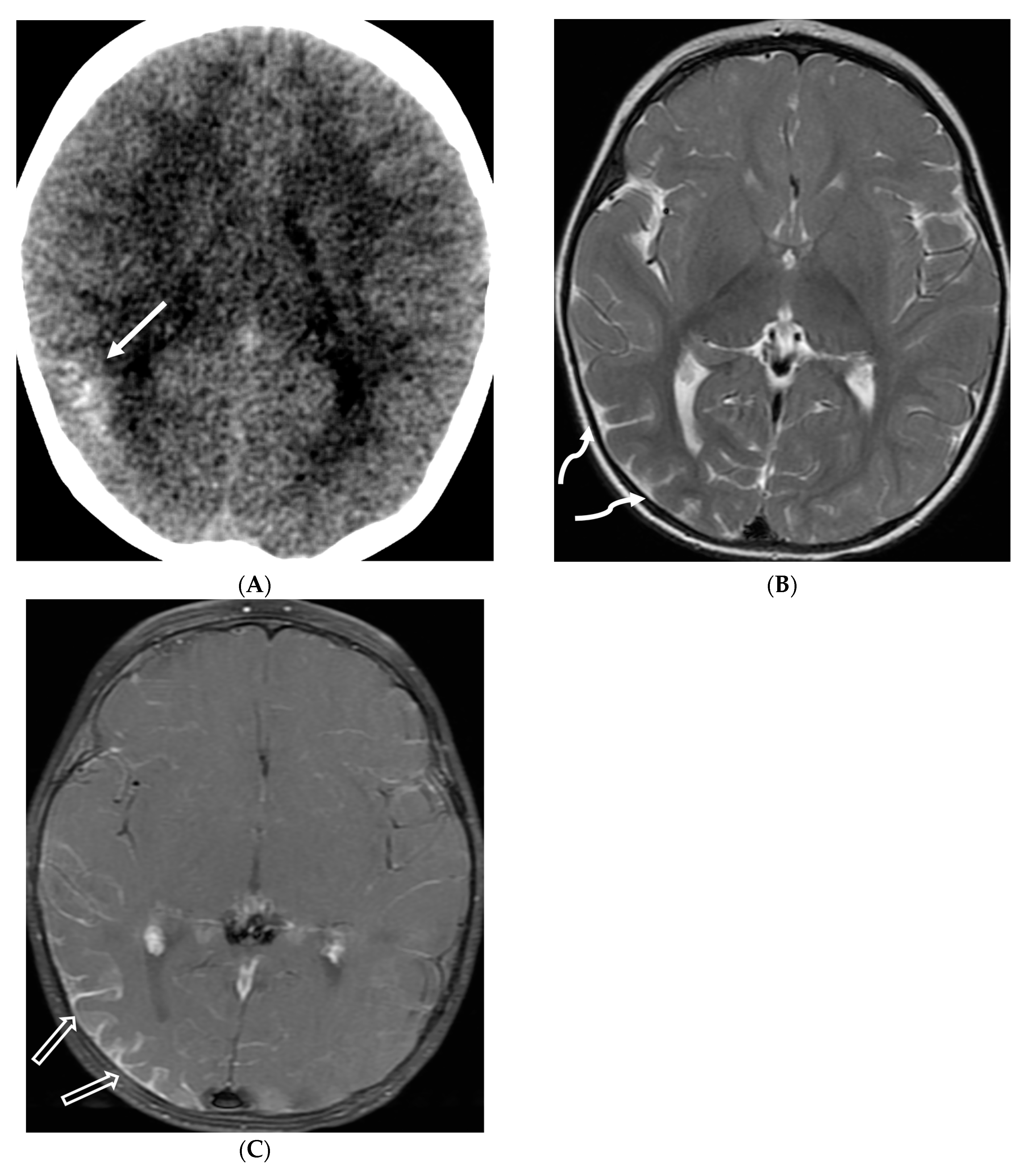 Tomography 10 00143 g025