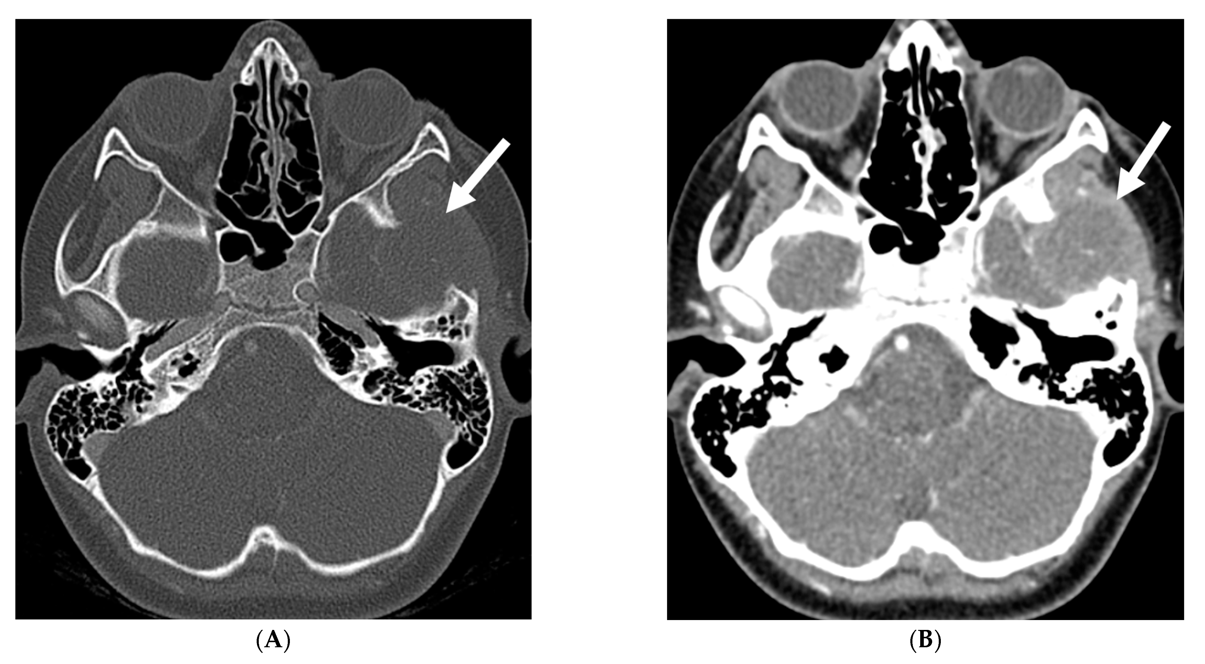Tomography 10 00143 g026a