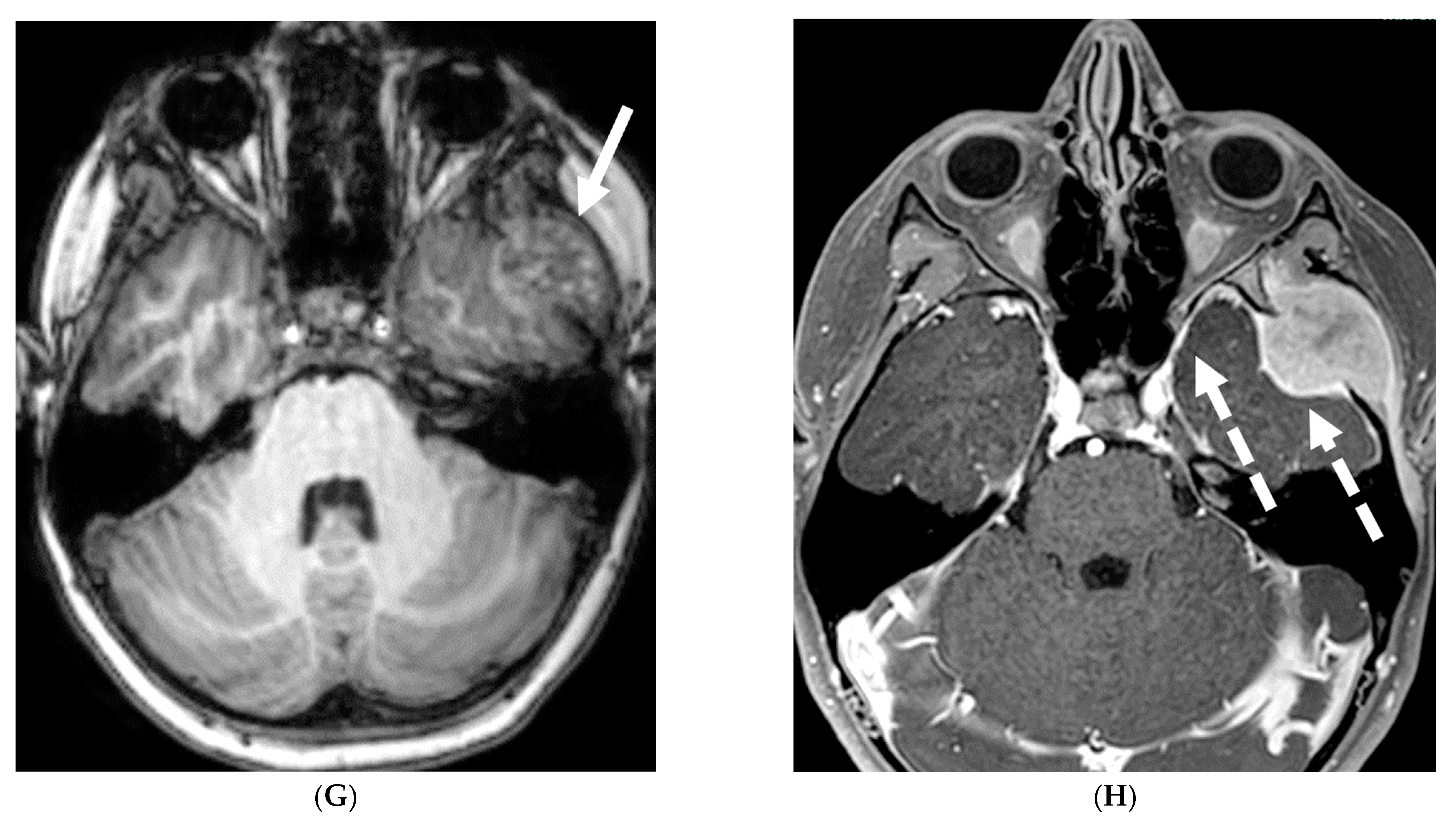 Tomography 10 00143 g026c
