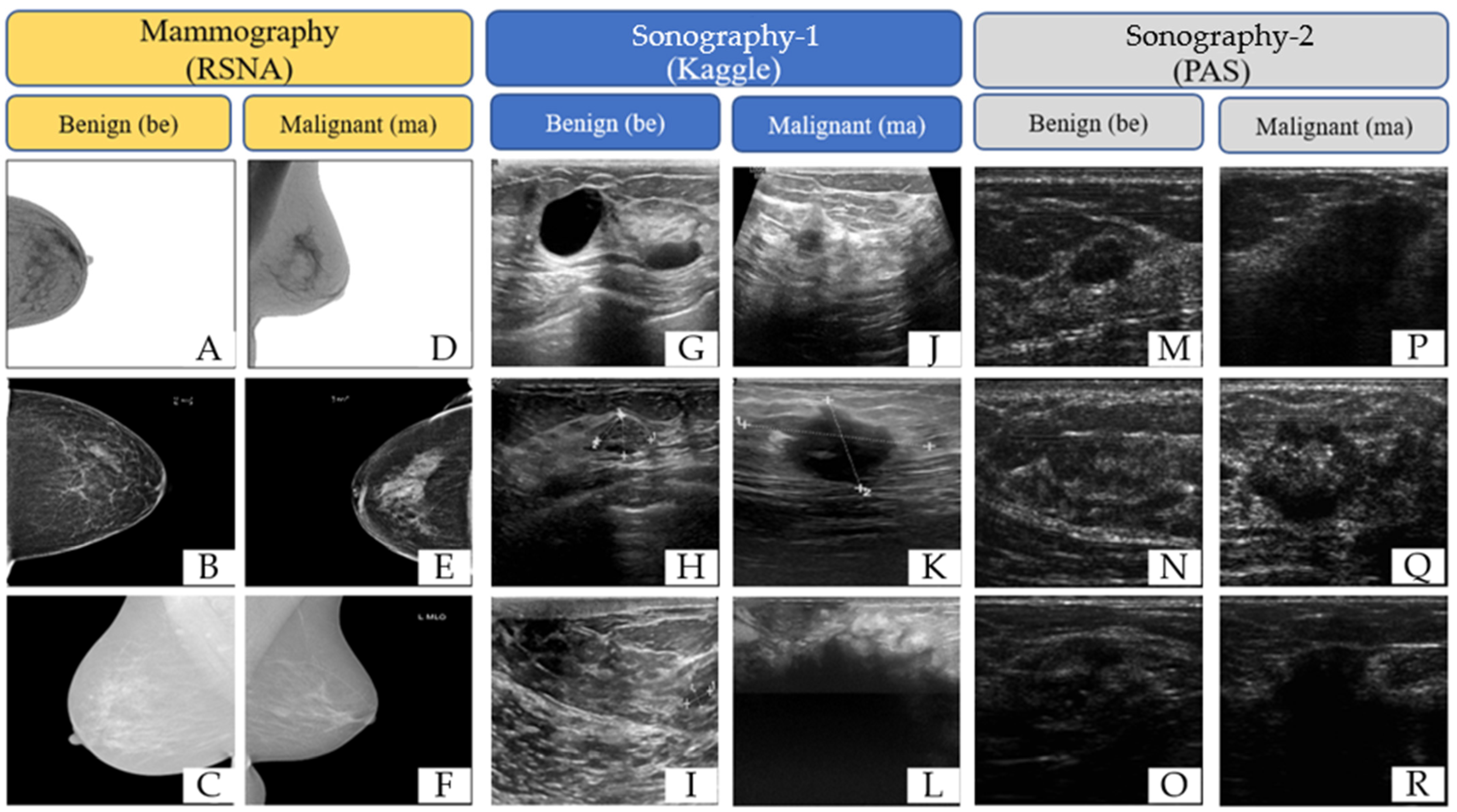 Tomography 10 00145 g002