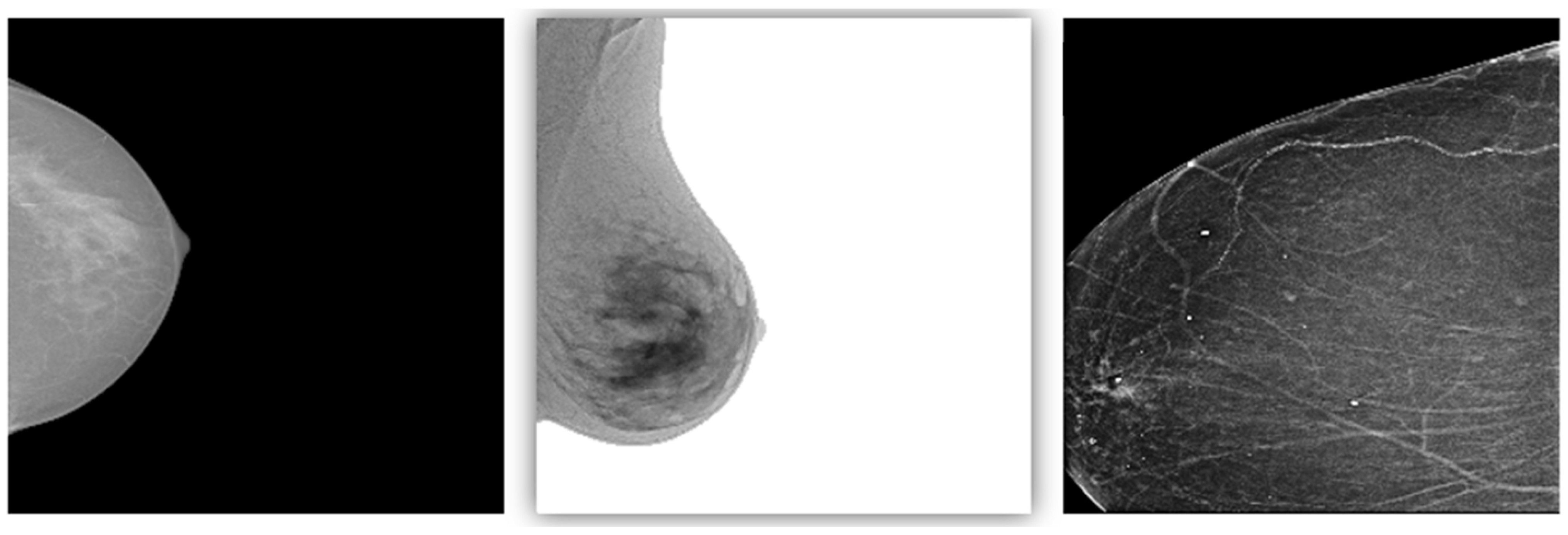 Tomography 10 00145 g011