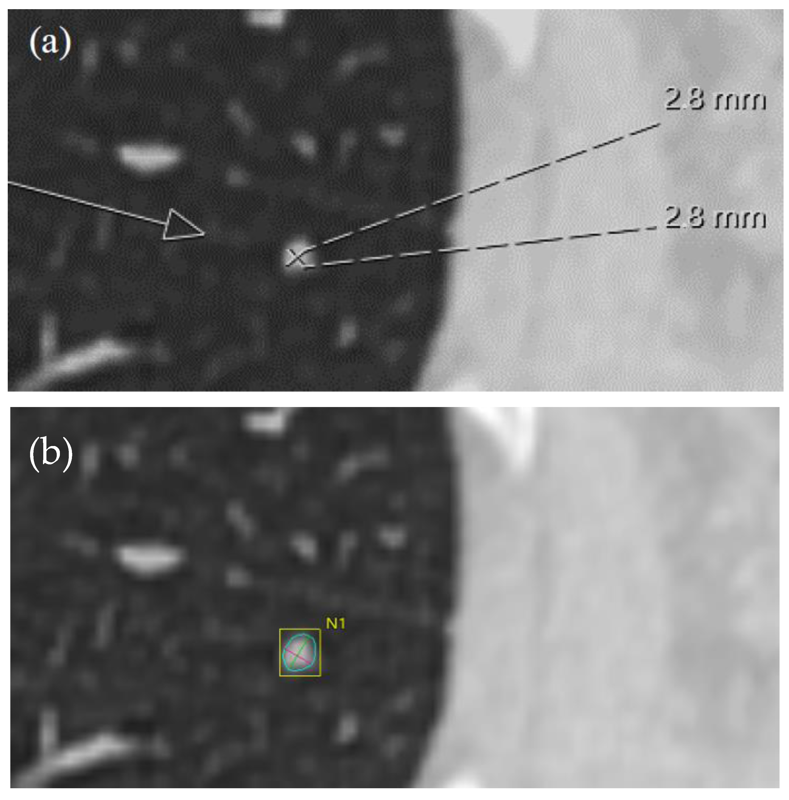 Tomography 10 00148 g006