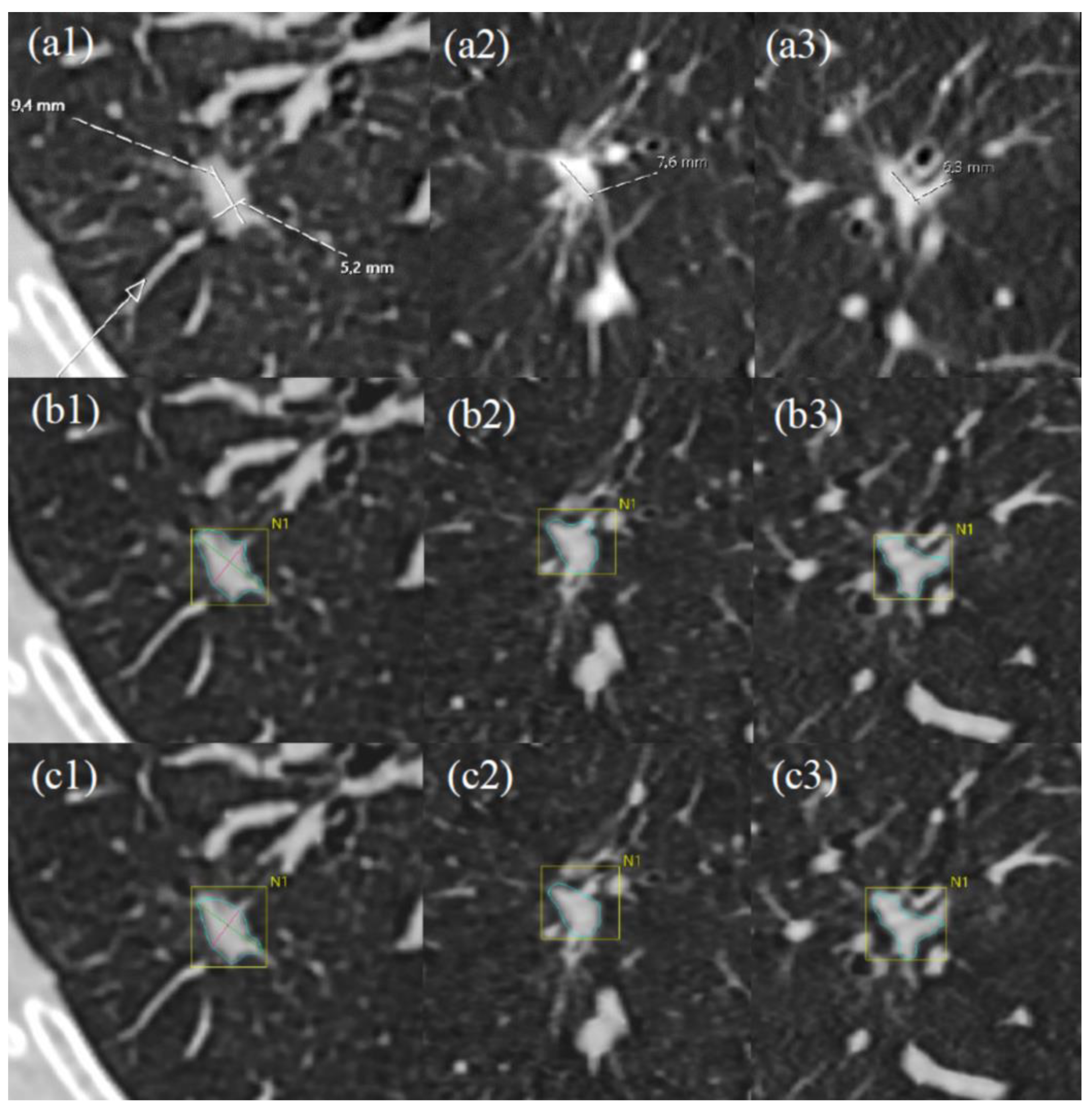 Tomography 10 00148 g007