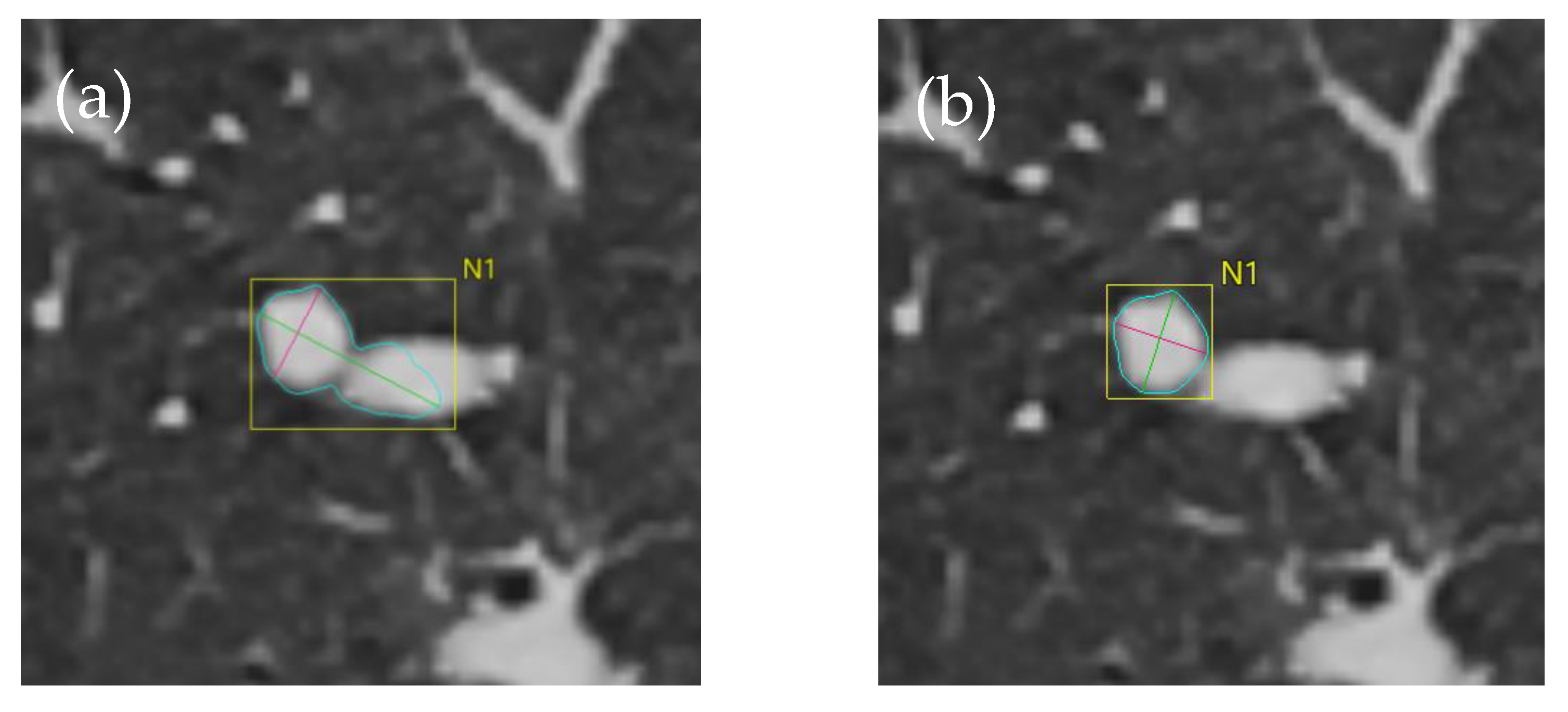 Tomography 10 00148 g008