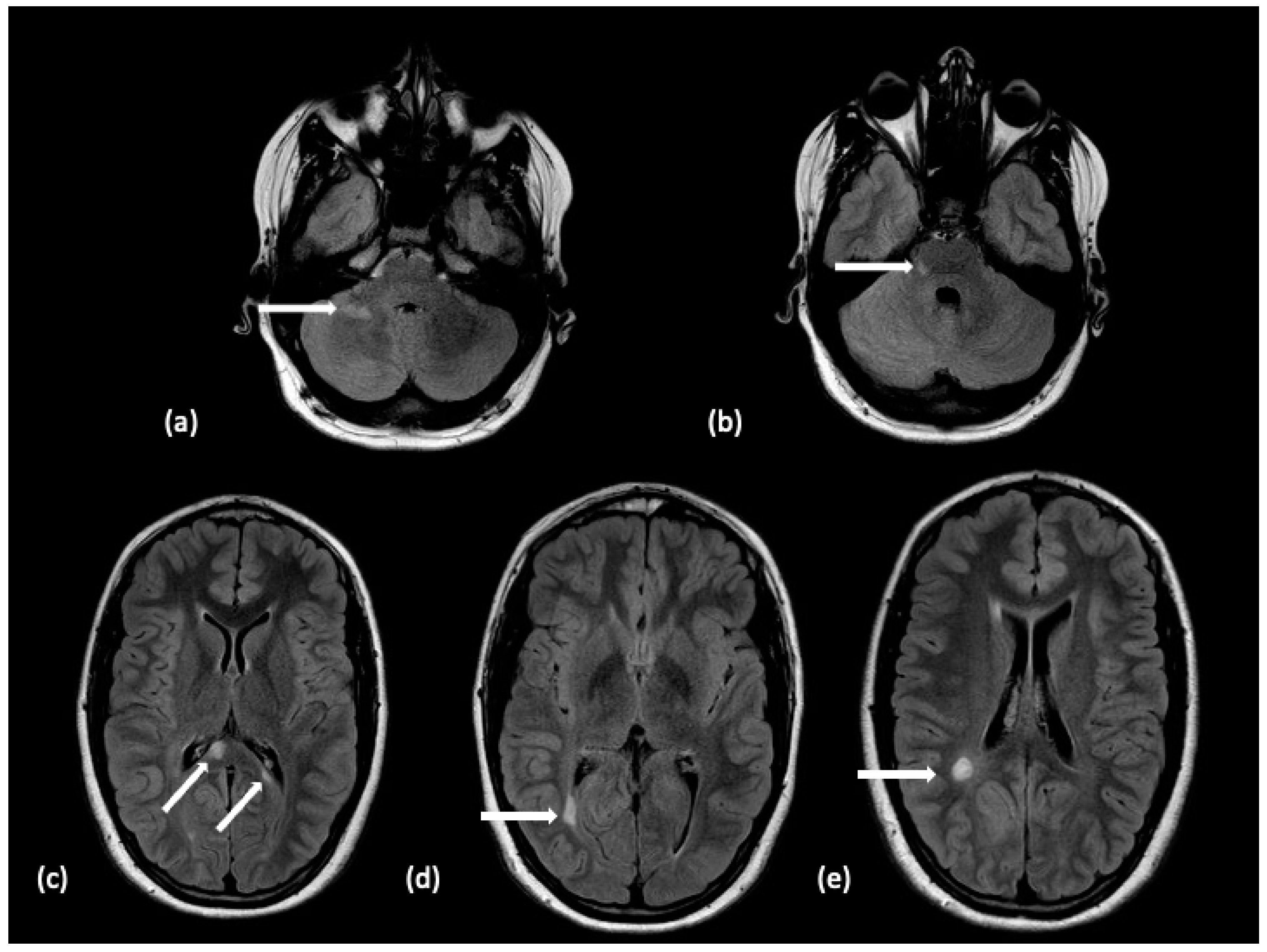 Tomography 10 00149 g001 Tomography 10 00149 g001