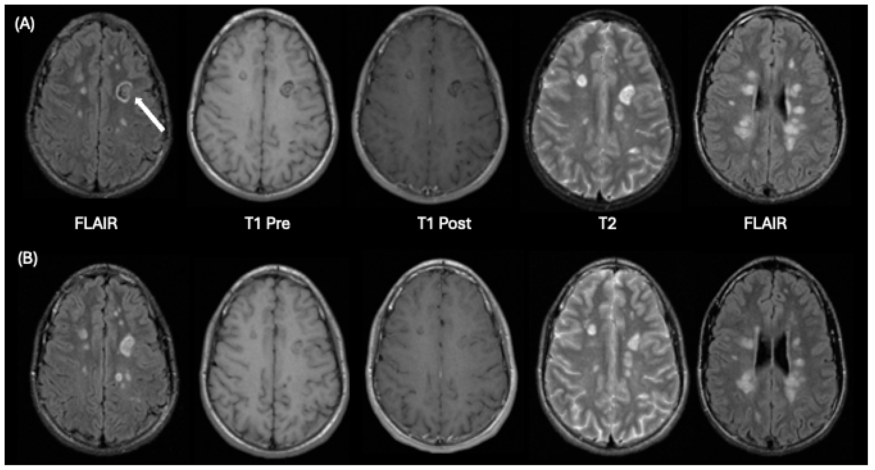 Tomography 10 00149 g003 Tomography 10 00149 g003