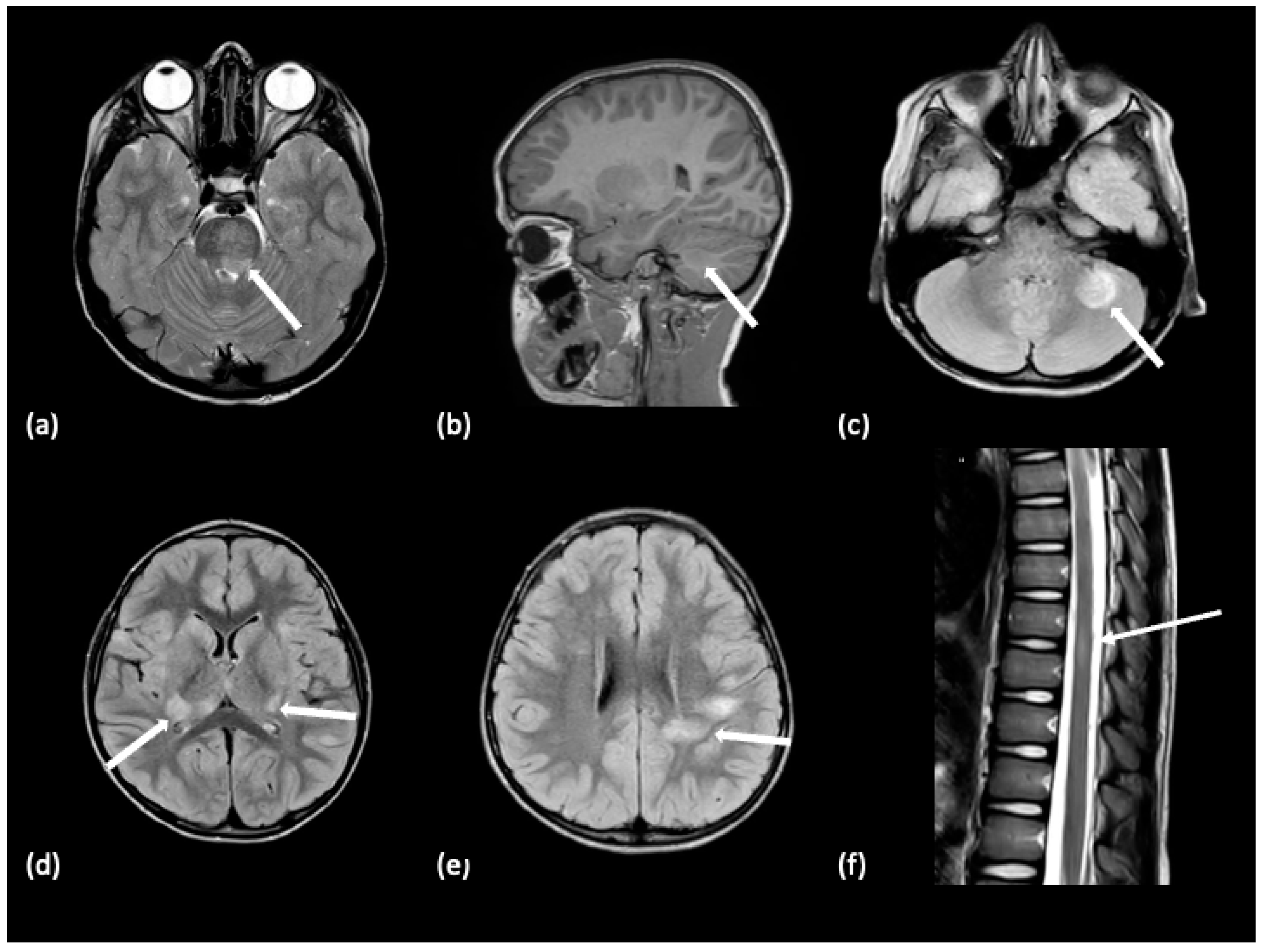 Tomography 10 00149 g005 Tomography 10 00149 g005
